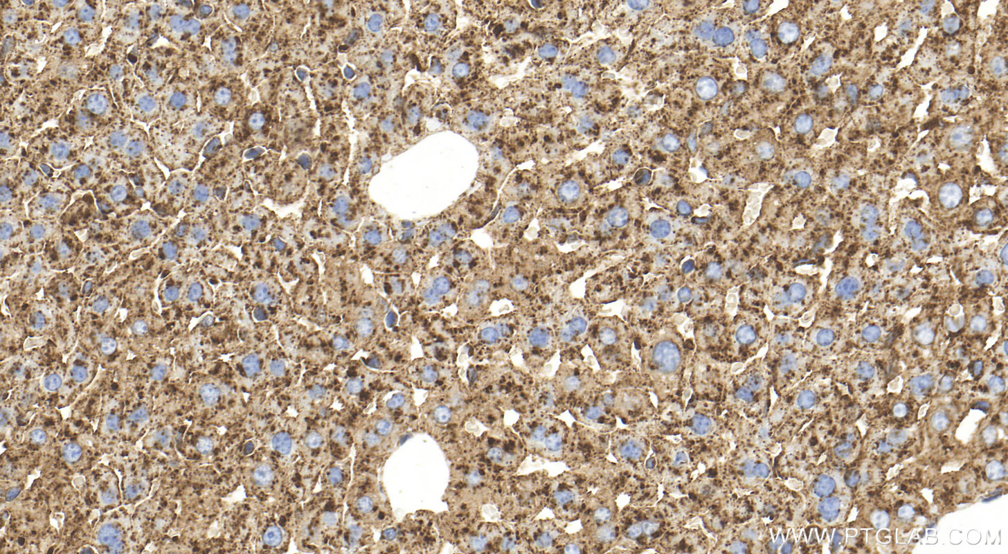 IHC staining of mouse liver using 32148-1-AP