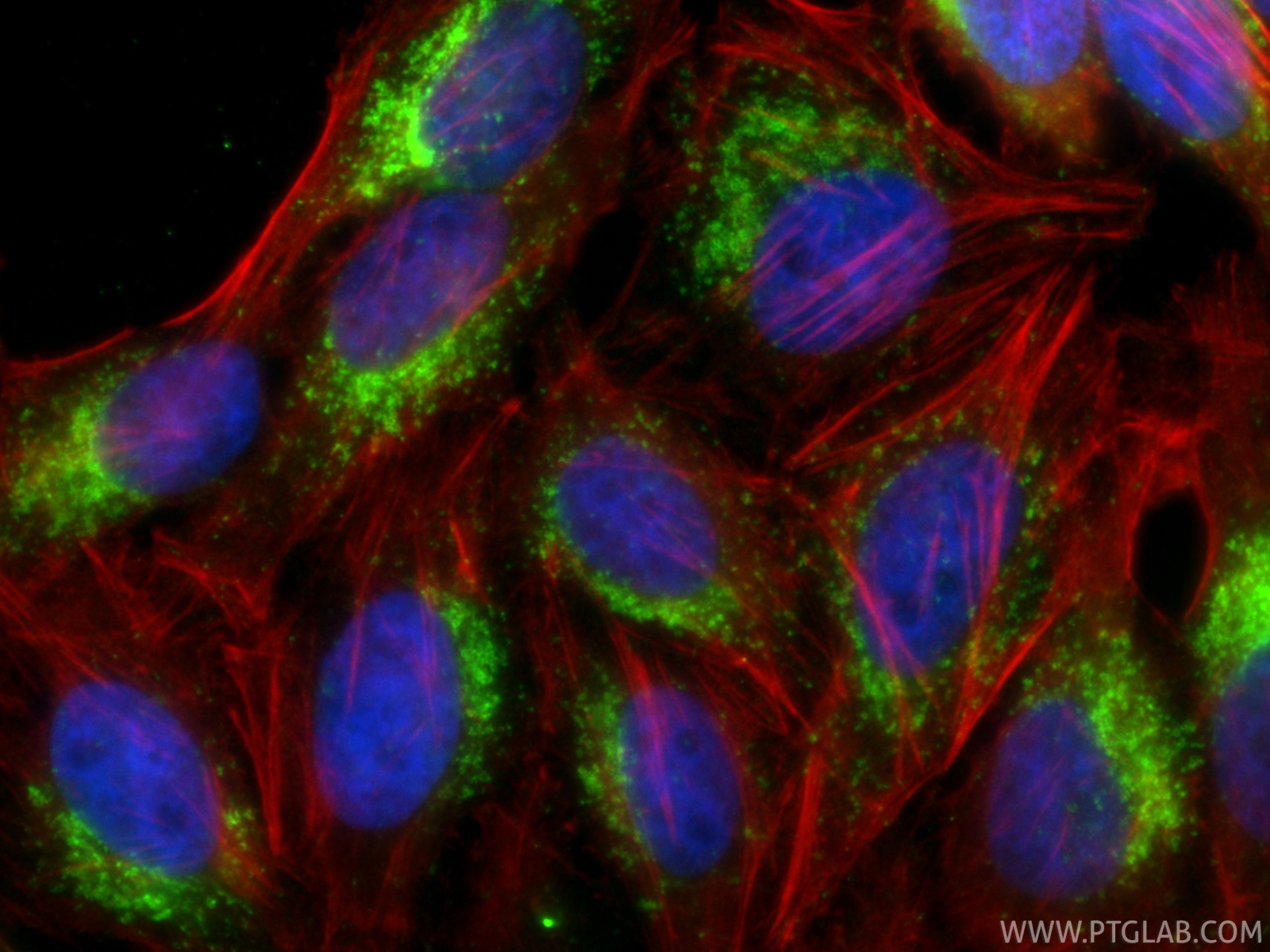 IF Staining of HepG2 using 34523-1-AP