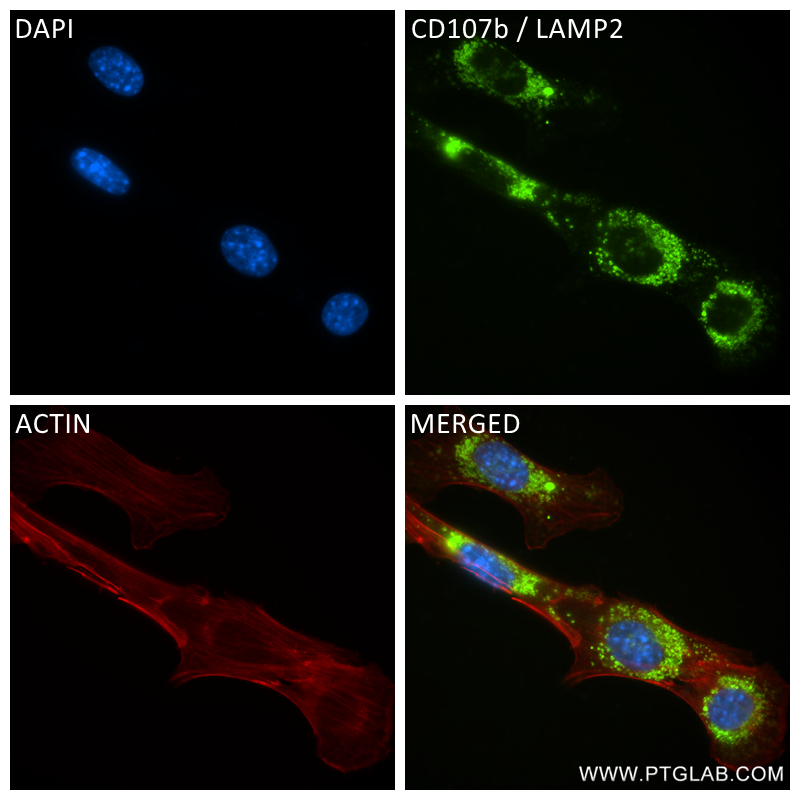 IF Staining of NIH/3T3 using 84474-5-RR