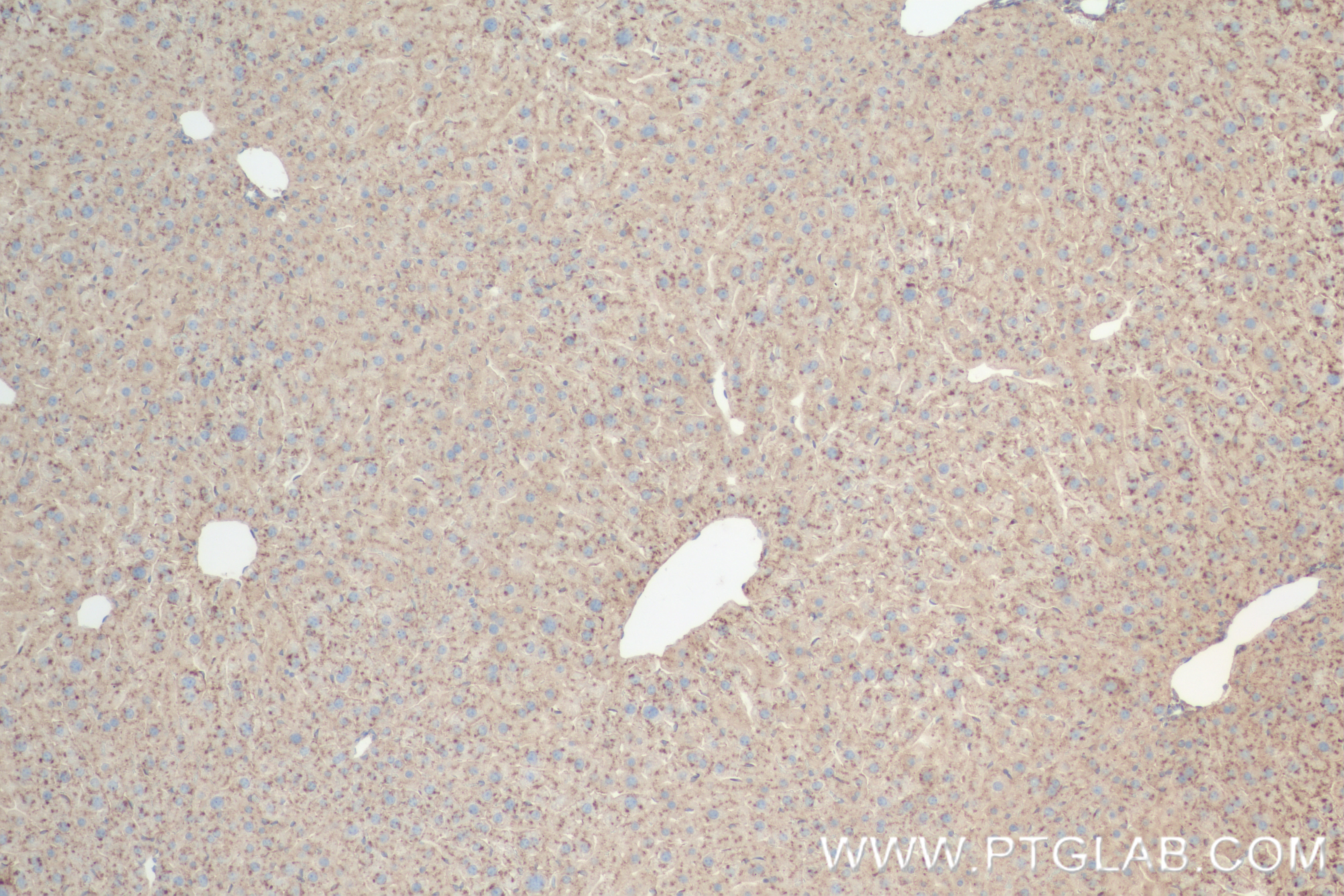 IHC staining of mouse liver using 84474-5-RR