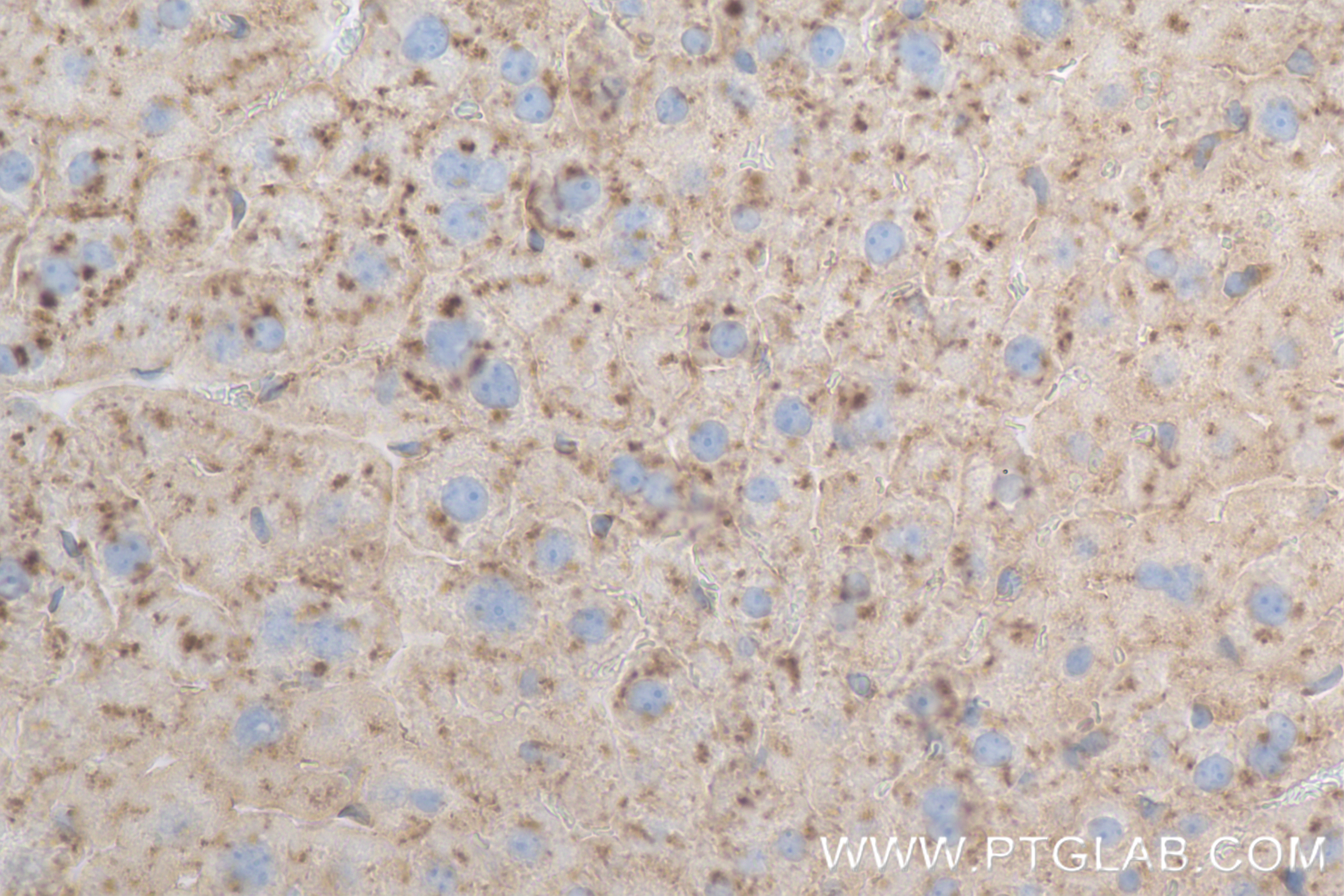 IHC staining of mouse liver using 84474-5-RR