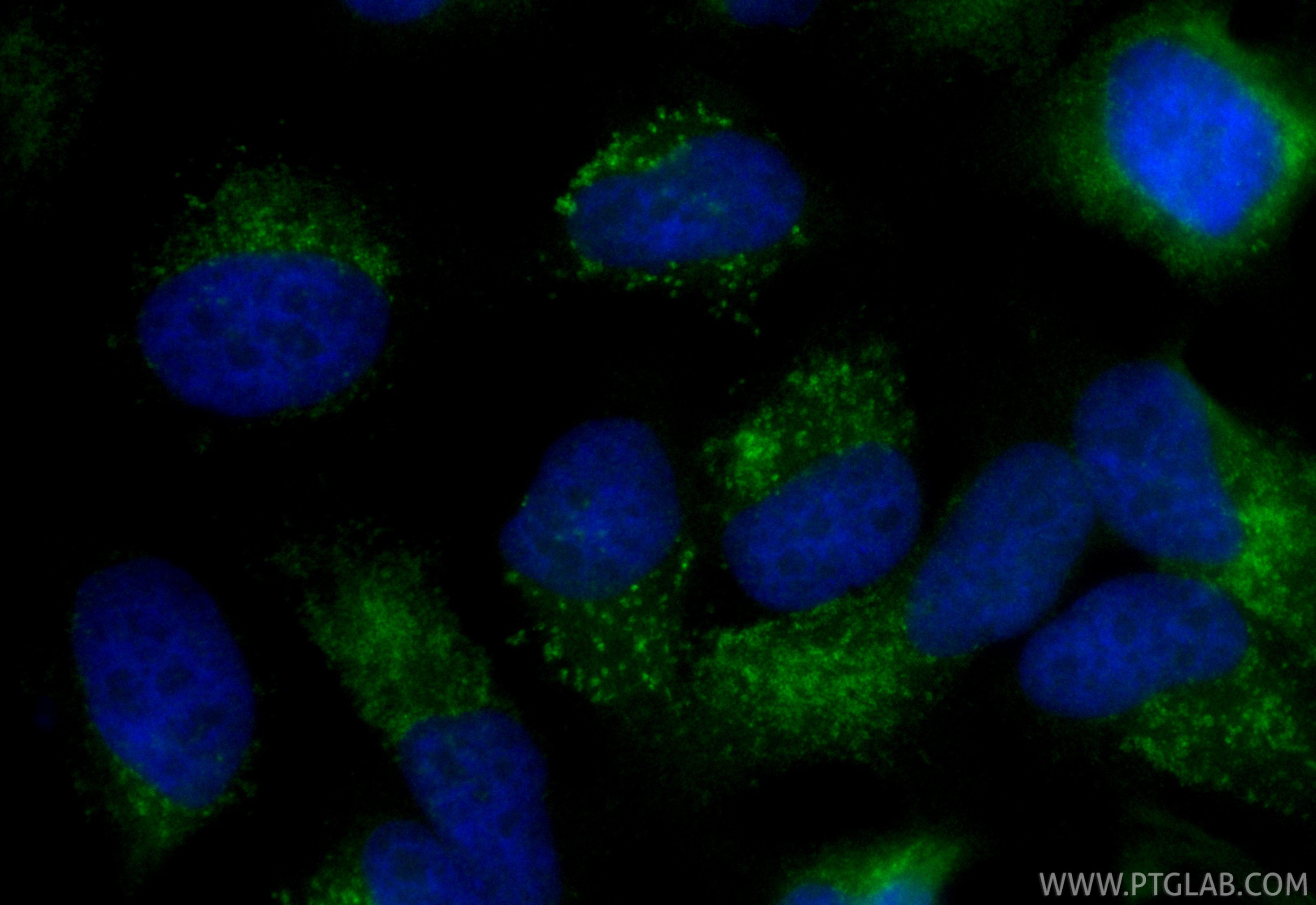 IF Staining of HeLa using CL488-SF65566 IF Staining of HeLa using CL488-SF65566