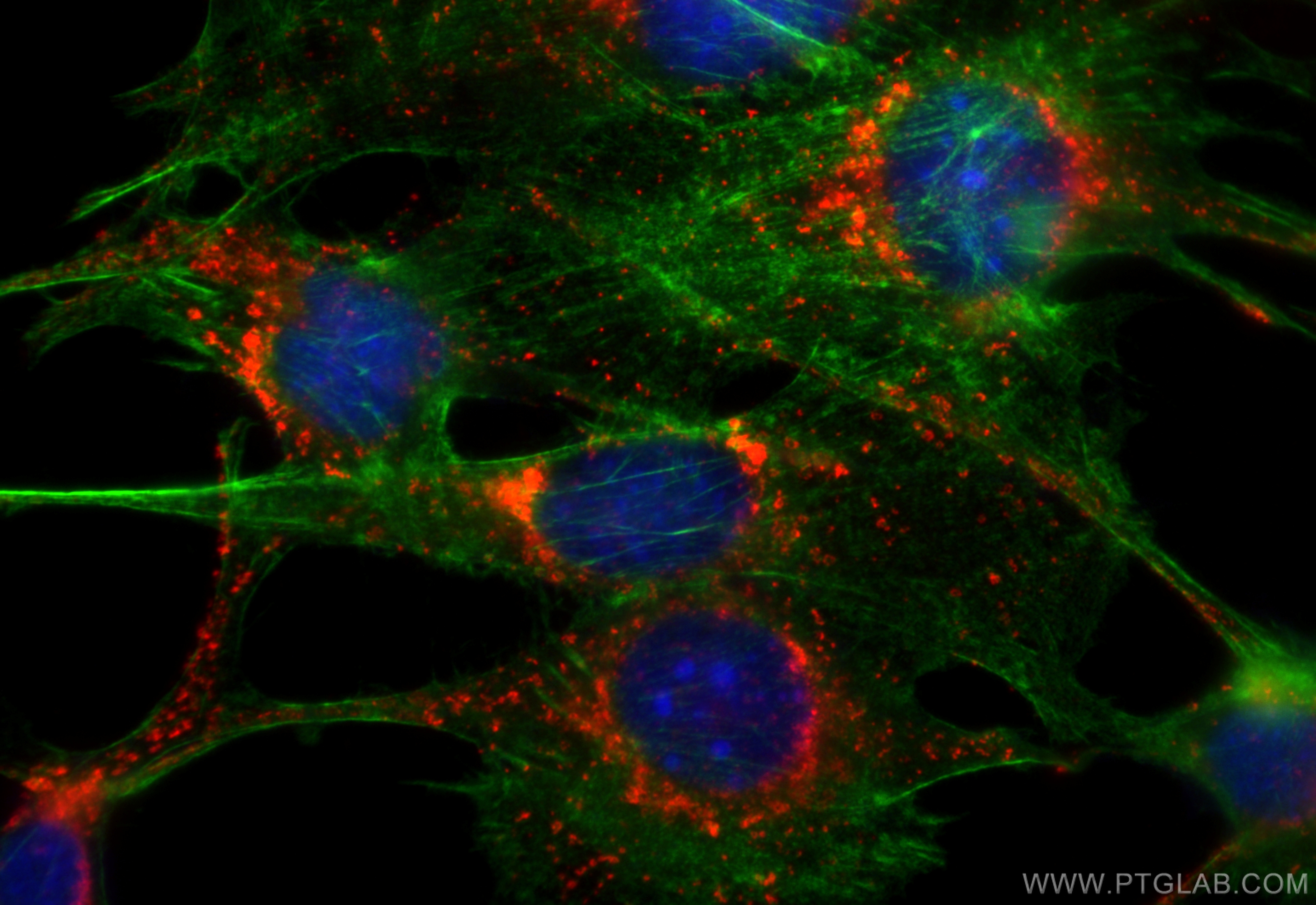 IF Staining of NIH/3T3 using CL594-84474-5