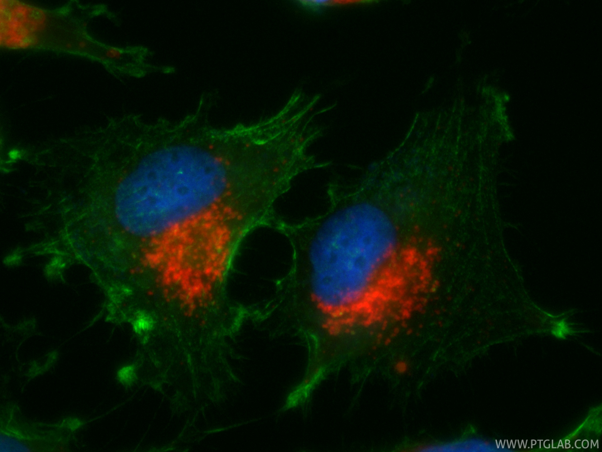IF Staining of U-251 using CL594-86269-3