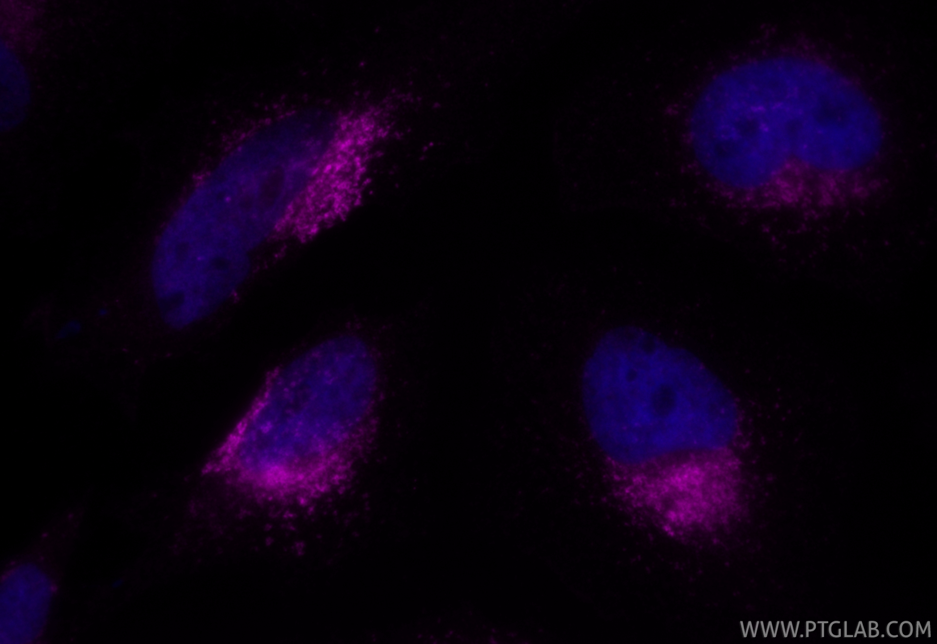 IF Staining of HeLa using CL647-FcA65566 IF Staining of HeLa using CL647-FcA65566