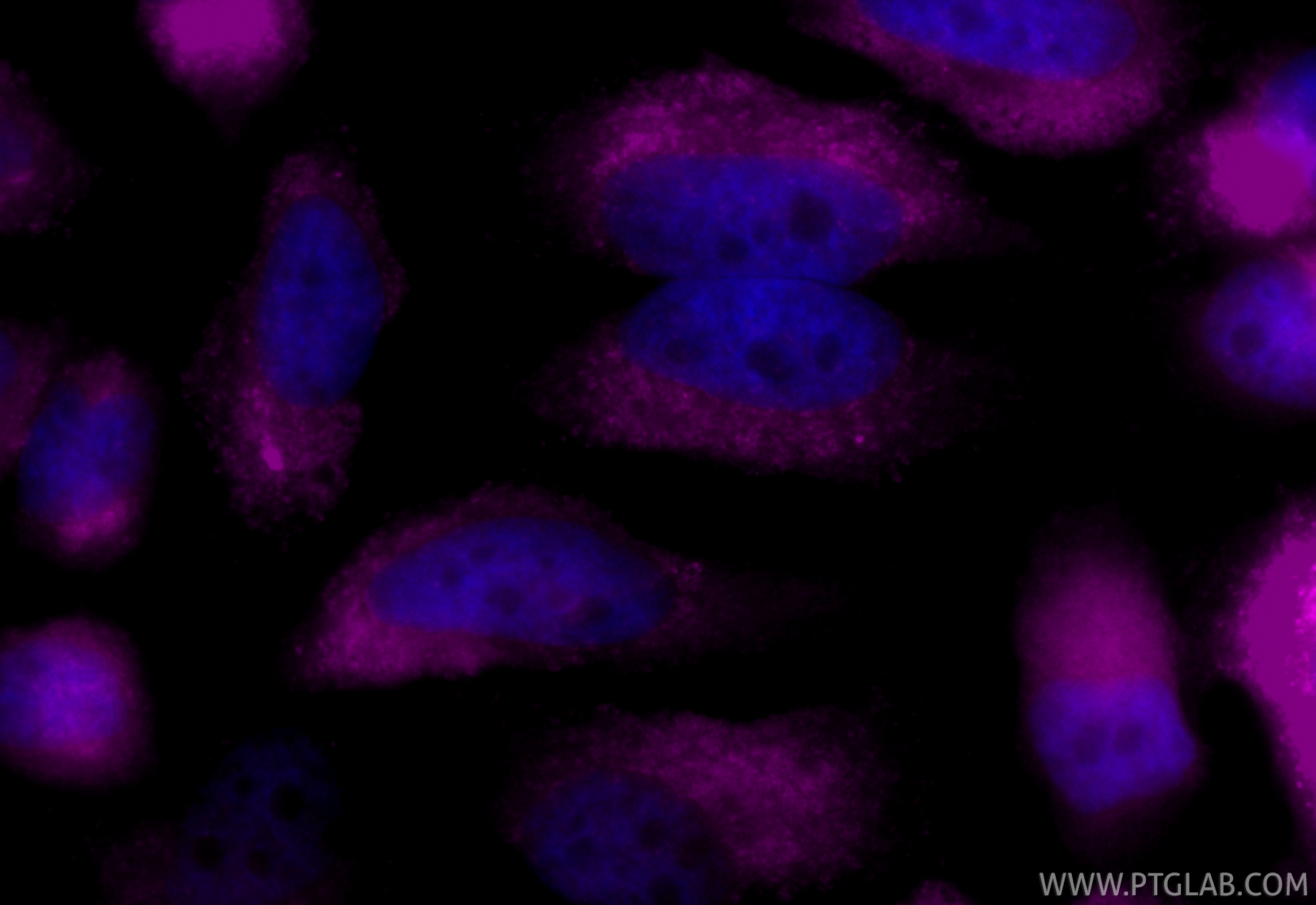 IF Staining of HeLa using CL647-SF65566