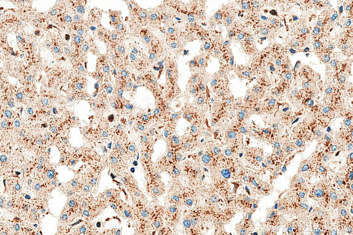 IHC staining of human liver using RMX00094