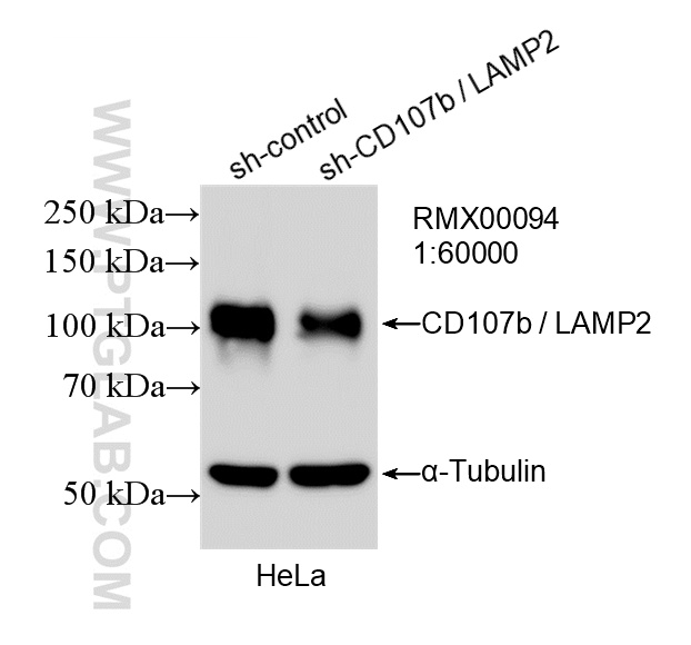 WB analysis of HeLa using RMX00094