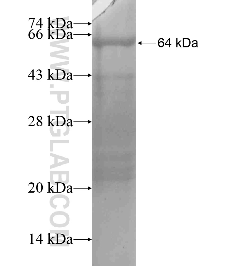 CD109 fusion protein Ag18229 SDS-PAGE CD109 fusion protein Ag18229 SDS-PAGE