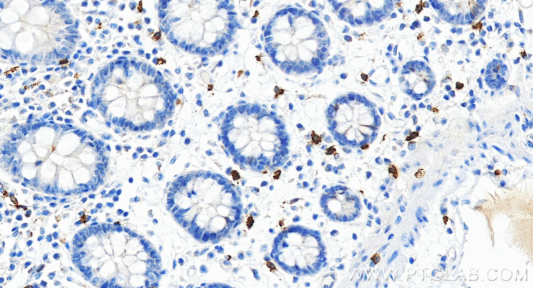Immunohistochemical analysis of paraffin-embedded human colon tissue slide using <a class='green' href='/productredirect?CatalogNo=84259-1-RR' target='_blank'>84259-1-RR</a> (CD117/c-Kit antibody) at dilution of 1:500 (under 20x lens). Heat mediated antigen retrieval with Tris-EDTA buffer (pH 9.0). This data was developed using the same antibody clone with 84259-1-PBS in a different storage buffer formulation. IHC staining of human colon using 84259-1-RR (same clone as 84259-1-PBS)