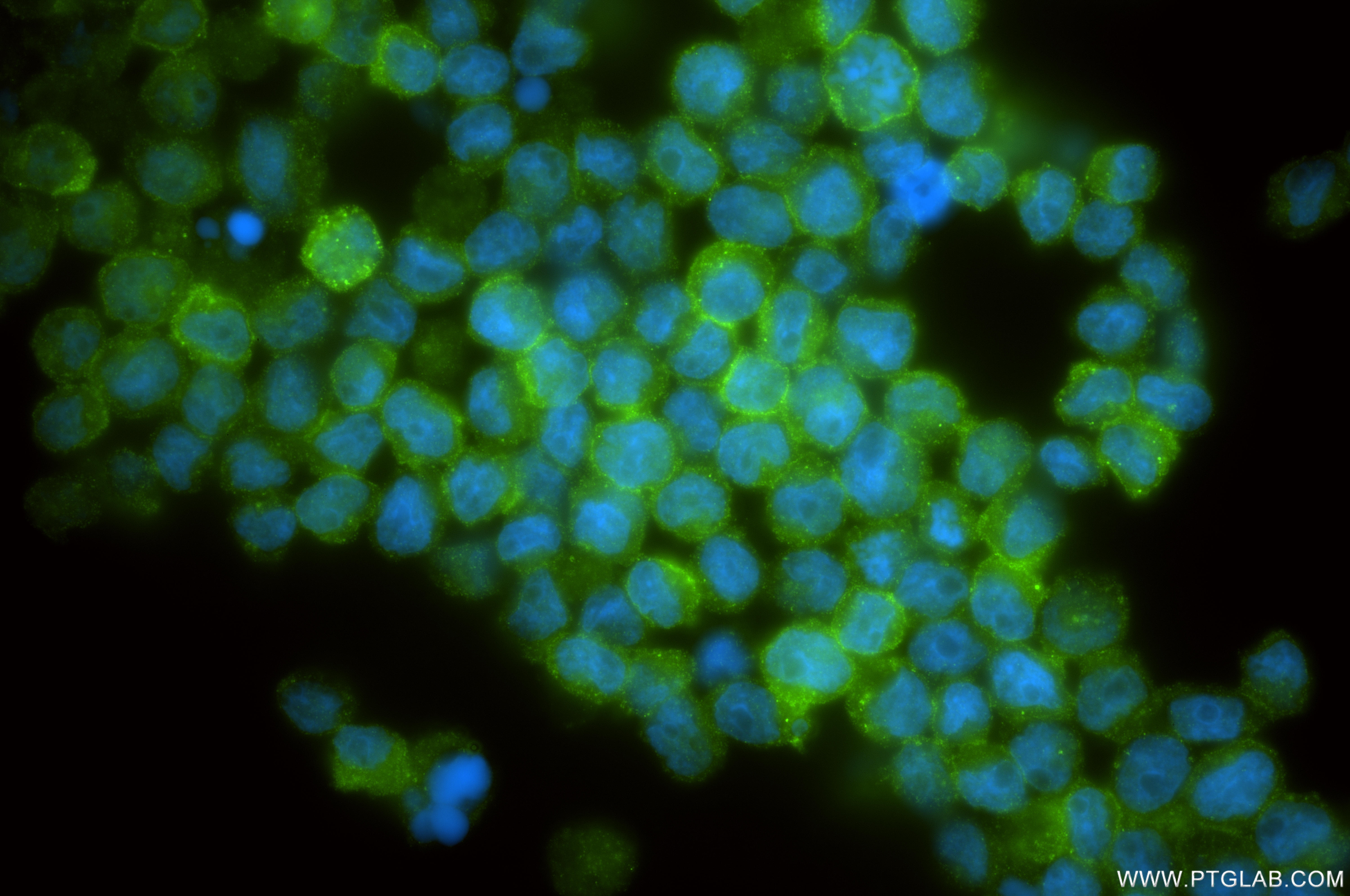 Immunofluorescent analysis of (4% PFA) fixed Kasumi-1 cells using CD117/c-Kit antibody (84259-10-RR, Clone: 242068G5 ) at dilution of 1:500 and CoraLite®488-Conjugated Goat Anti-Rabbit IgG(H+L) (<a class='green' href='/productredirect?CatalogNo=SA00013-2' target='_blank'>SA00013-2</a>). IF Staining of Kasumi-1 using 84259-10-RR