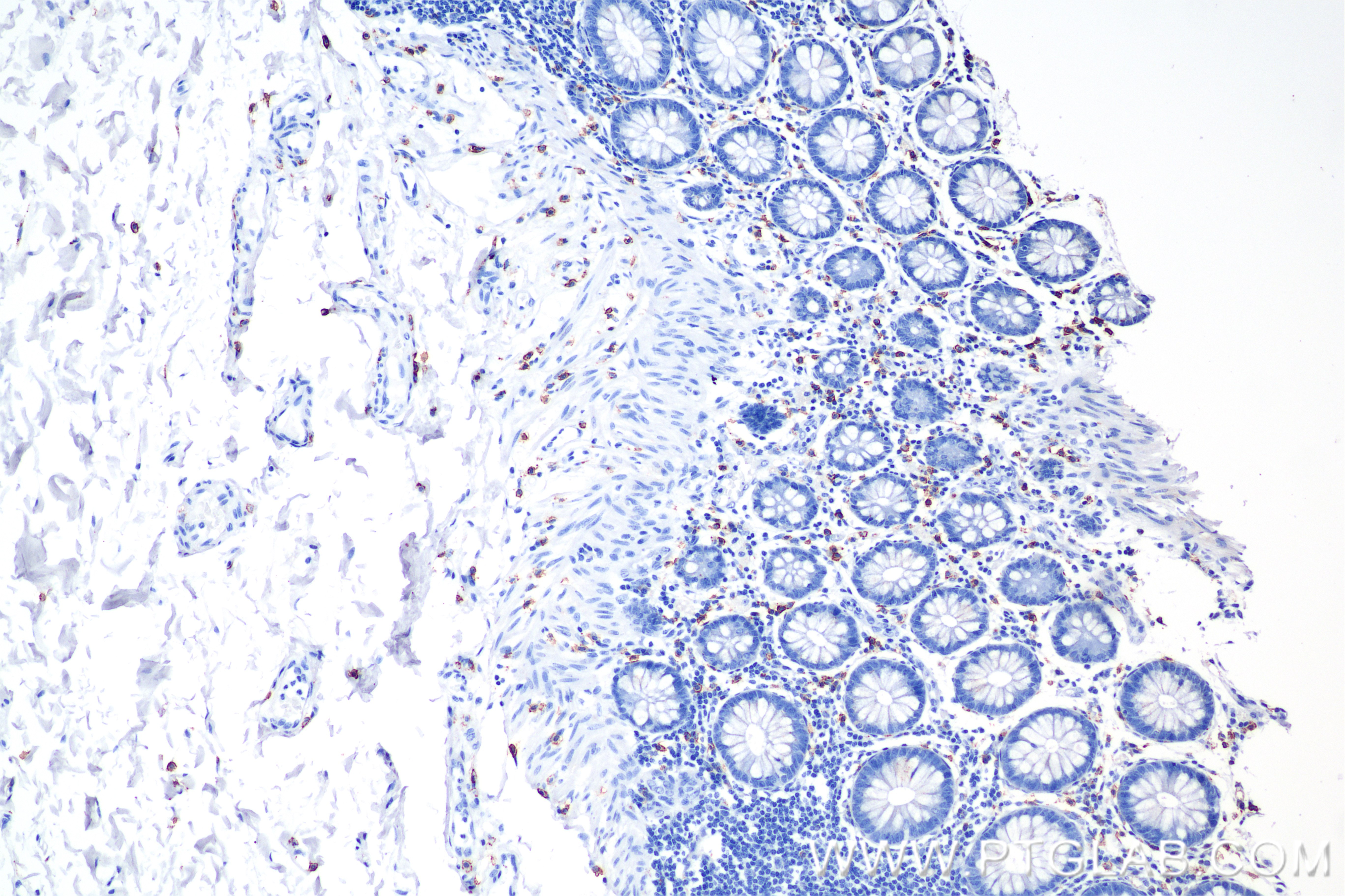 Immunohistochemical analysis of paraffin-embedded human colon tissue slide using 84259-10-RR (C-Kit antibody) at dilution of 1:5000 (under 10x lens). Heat mediated antigen retrieval with Sodium Citrate buffer (pH 6.0). IHC staining of human colon using 84259-10-RR