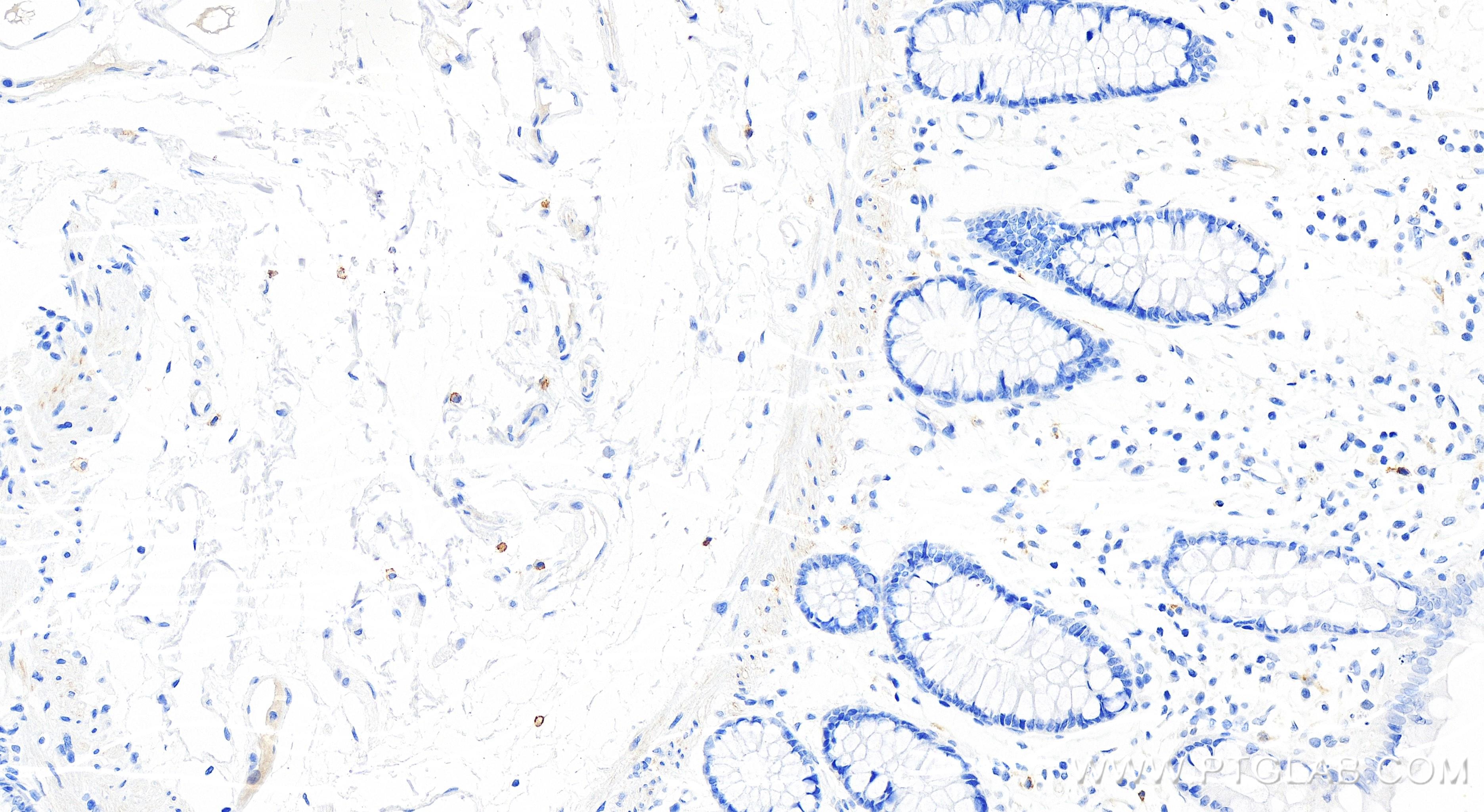 IHC staining of human colon using 84259-5-RR