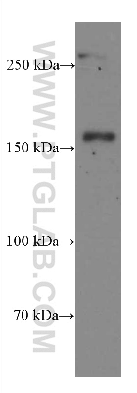 CD11B/Integrin Alpha M