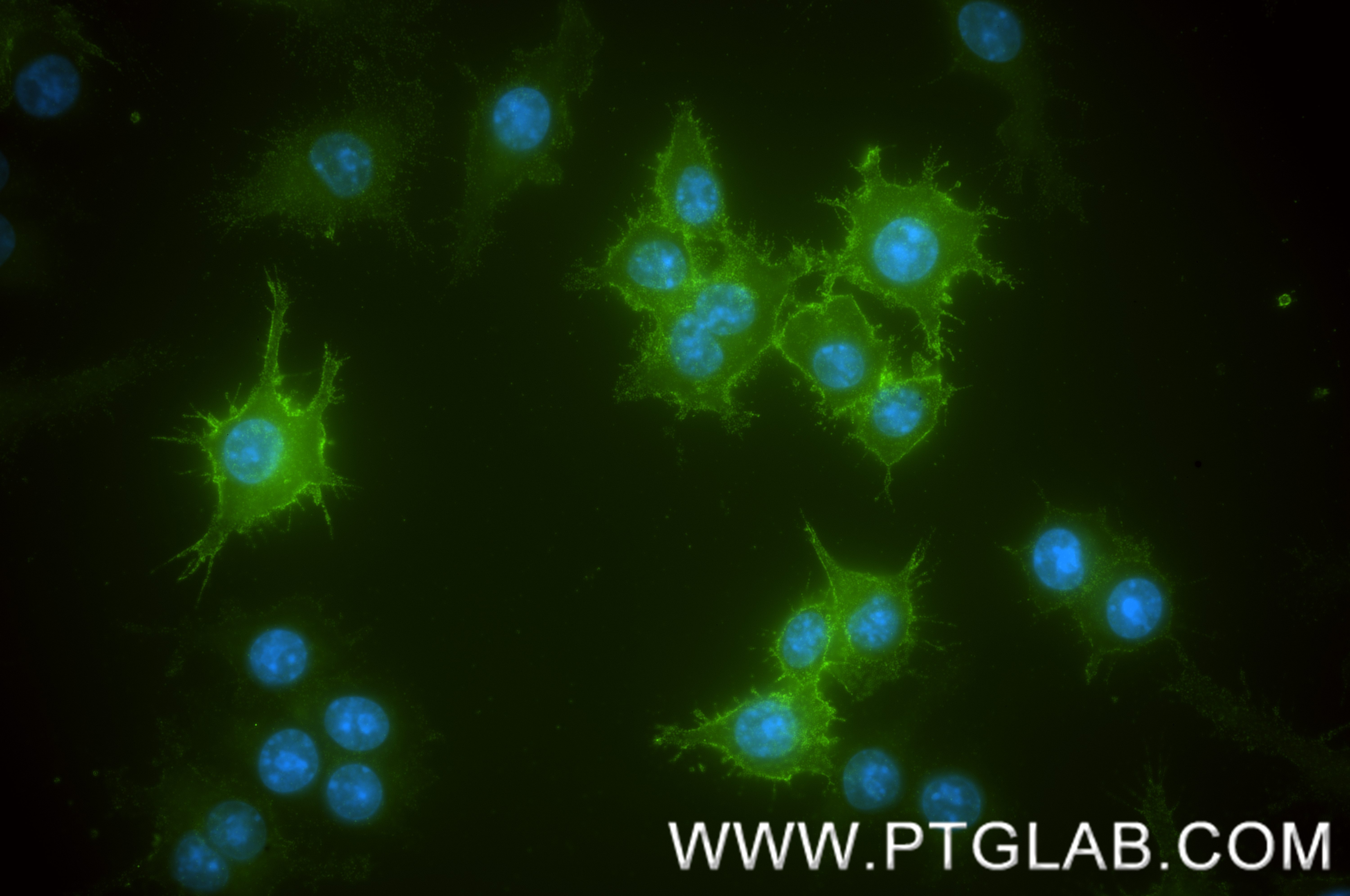 IF Staining of RAW 264.7 using 87542-1-RR