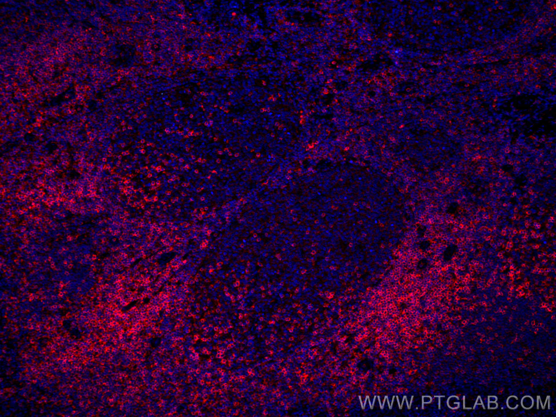 IF Staining of human tonsillitis using CL594-66256