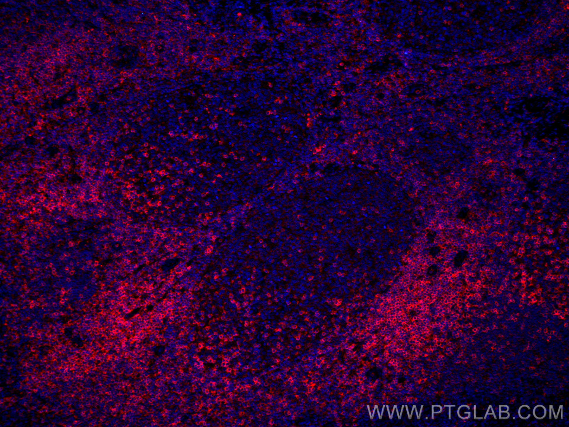CD11a/Integrin Alpha L