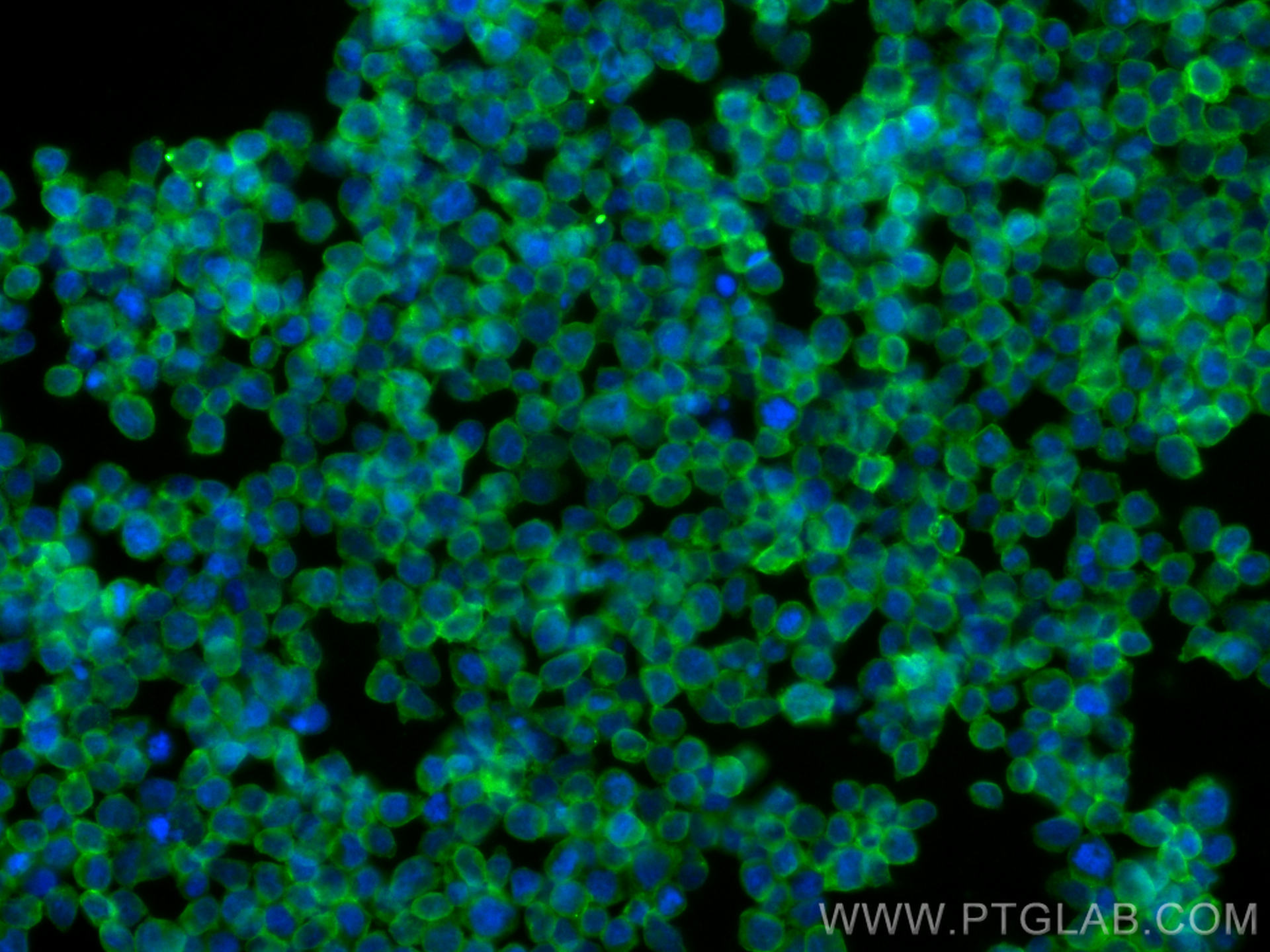 IF Staining of Jurkat using 66256-1-Ig
