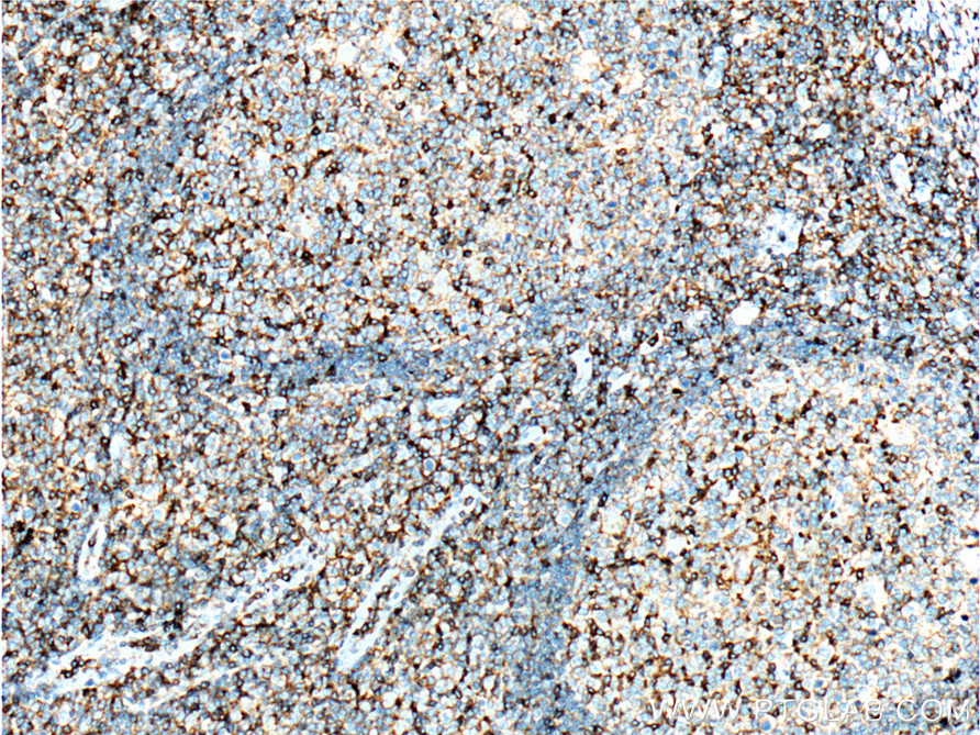 CD11a/Integrin Alpha L Monoclonal antibody