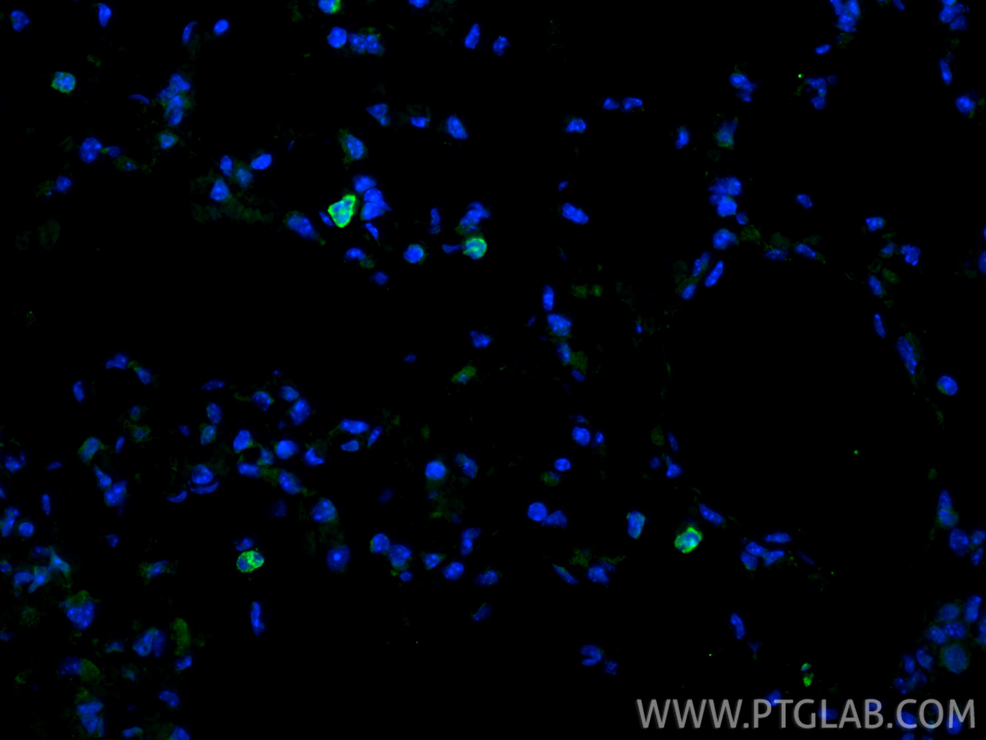 IF Staining of mouse lung using 31745-1-AP