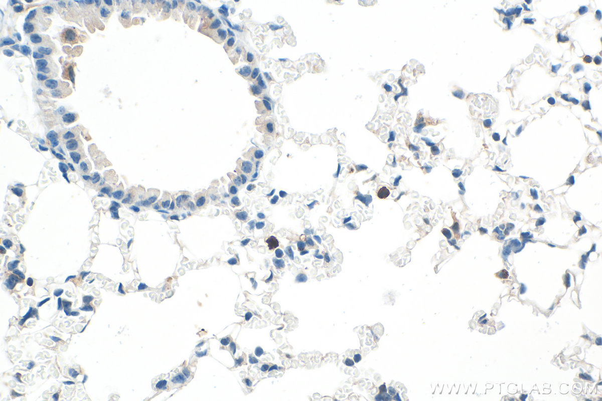IHC staining of mouse lung using 31745-1-AP