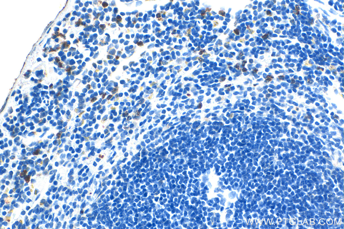 IHC staining of mouse spleen using 31745-1-AP