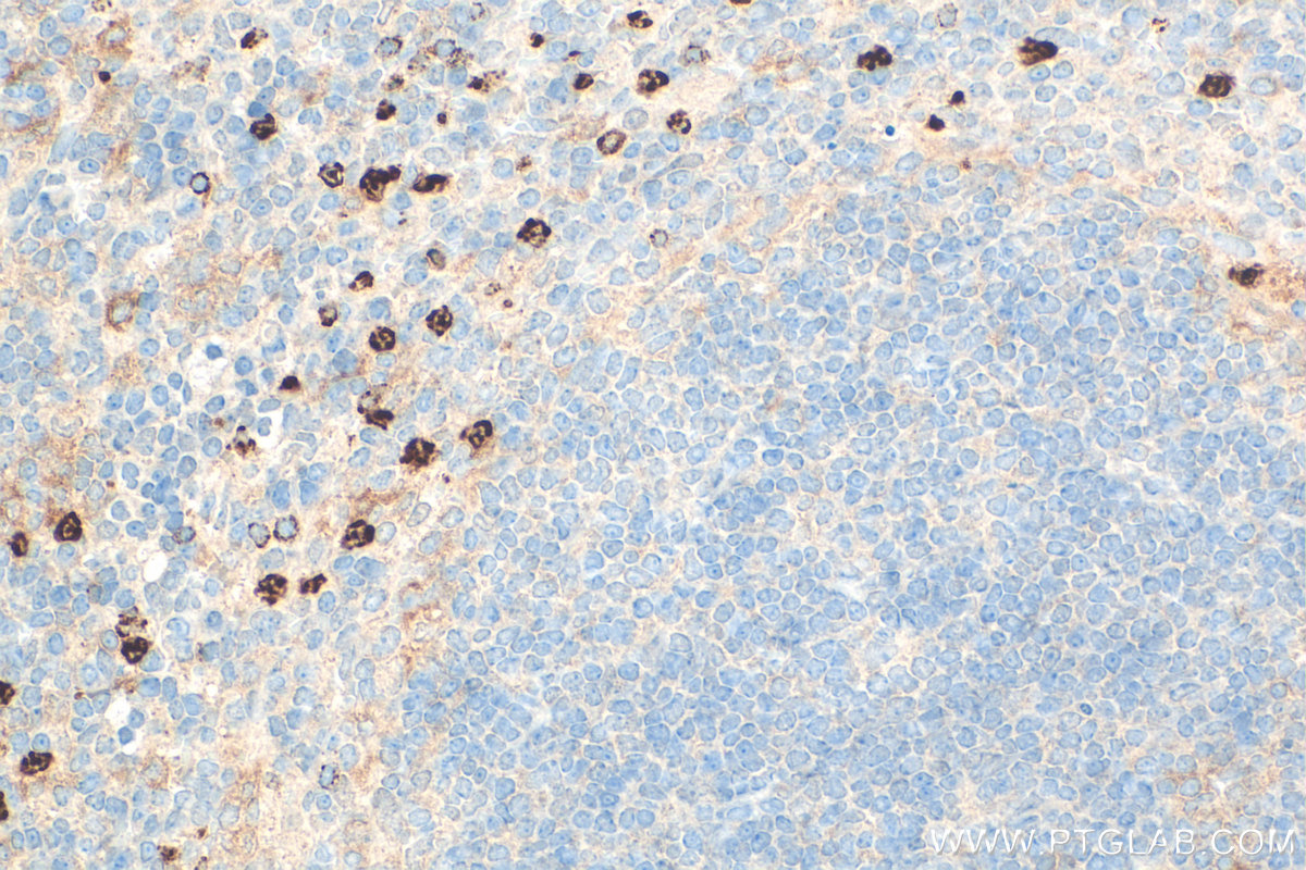 IHC staining of mouse spleen using 31745-1-AP IHC staining of mouse spleen using 31745-1-AP