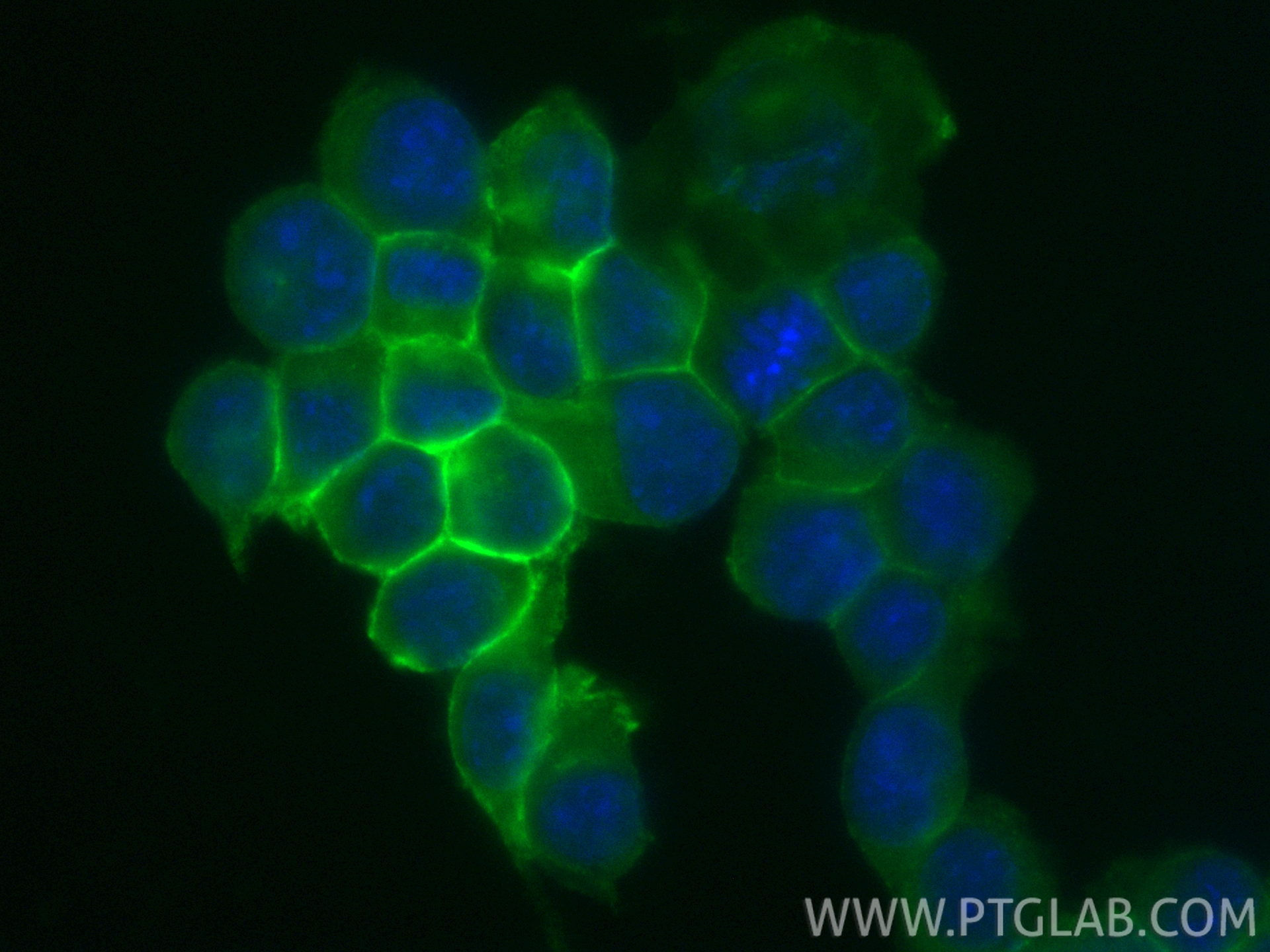 IF Staining of BV-2 using CL488-65055