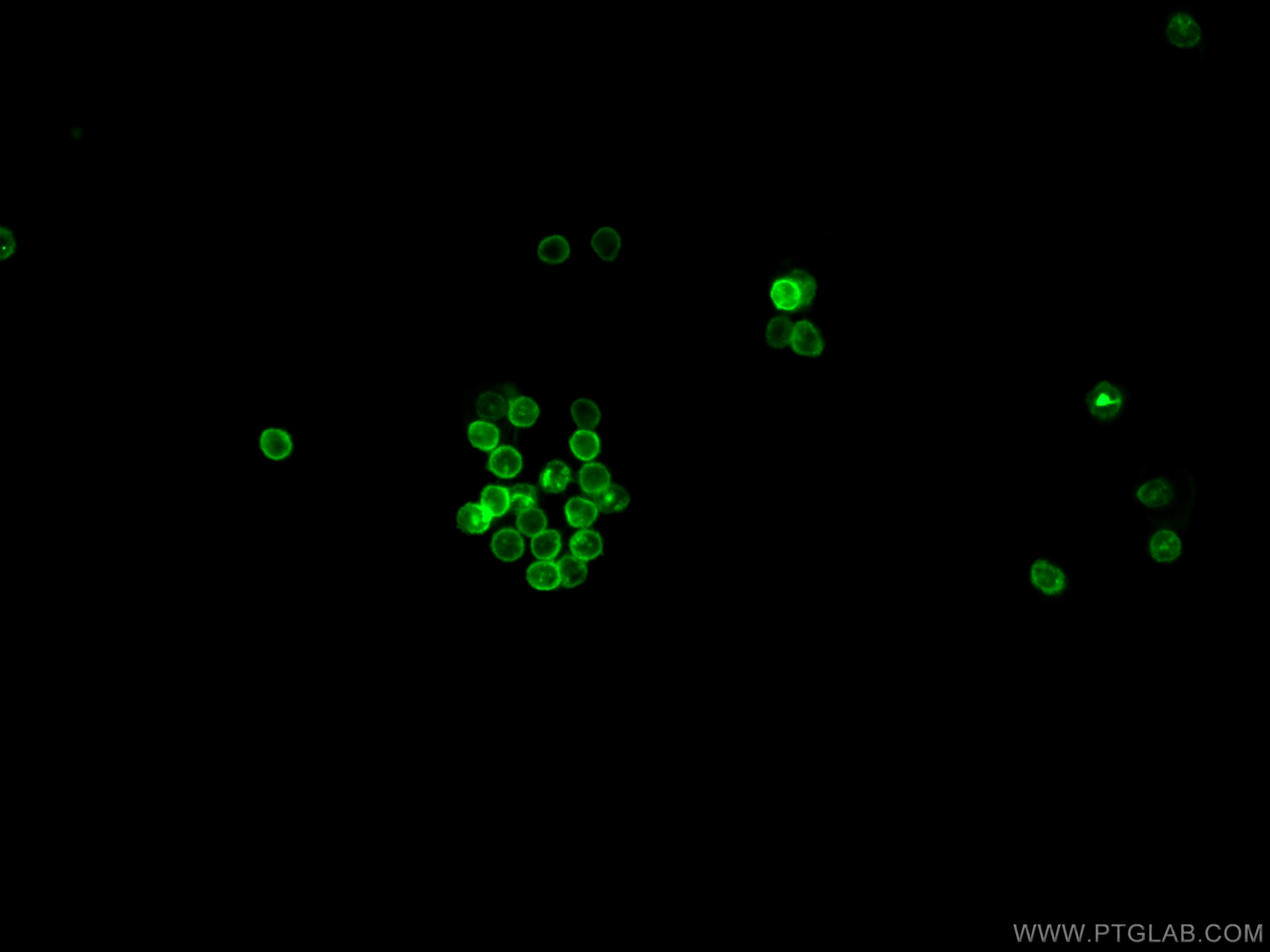 IF Staining of human peripheral blood mononuclear cells using CL488-65116