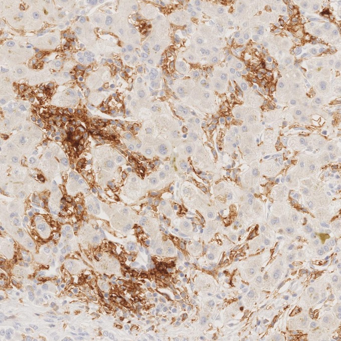 IHC staining of human liver using 81853-1-RR IHC staining of human liver using 81853-1-RR