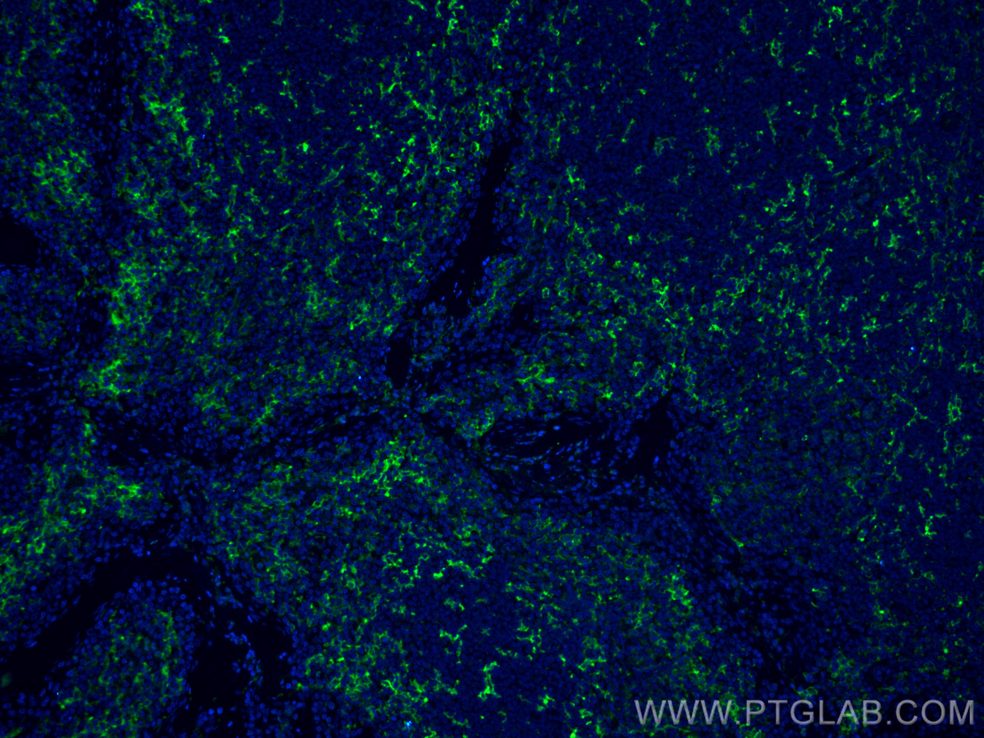 IF Staining of human tonsillitis using CL488-60258