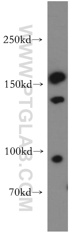 WB analysis of Jurkat using 55162-1-AP