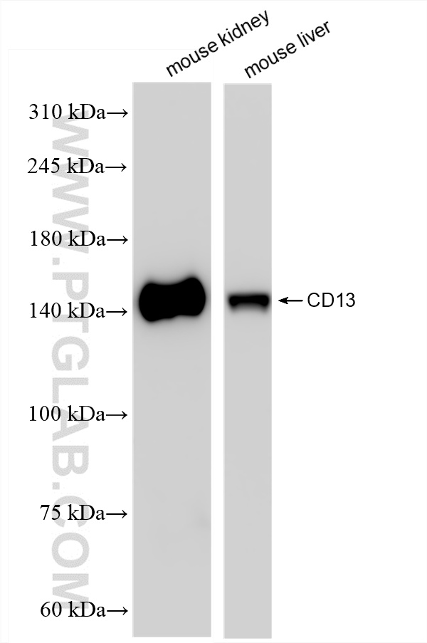 WB analysis using 85152-5-RR