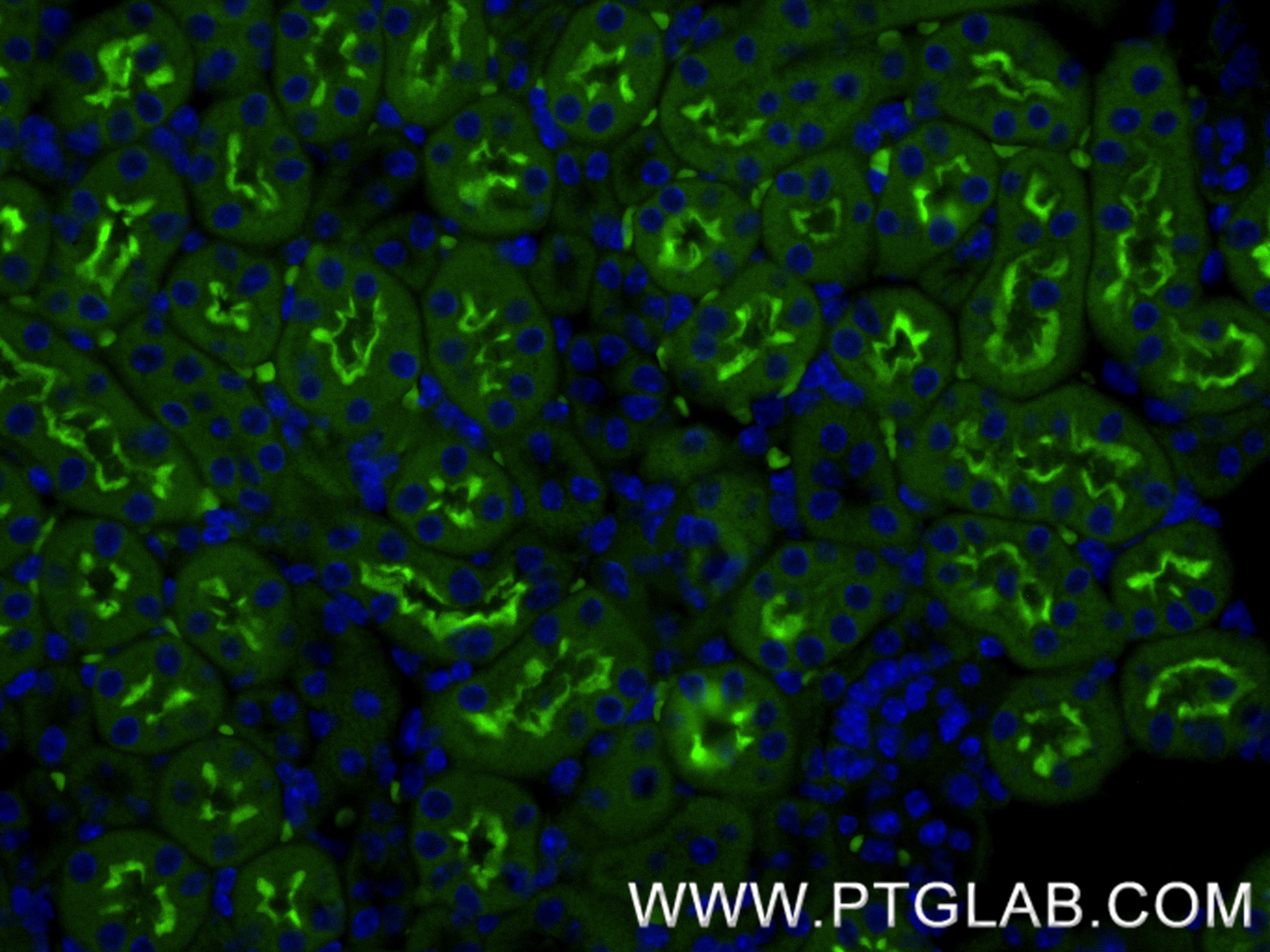 IF Staining of mouse kidney using 85152-6-RR