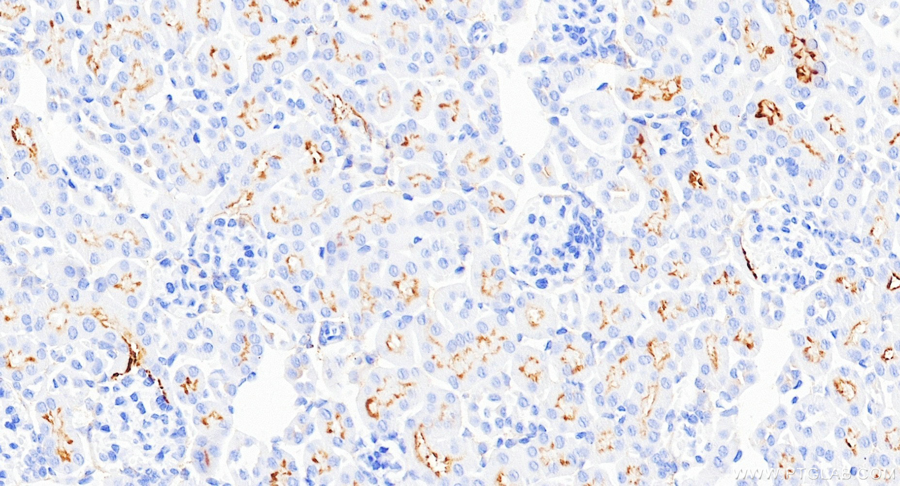 IHC staining of mouse kidney using 85152-6-RR