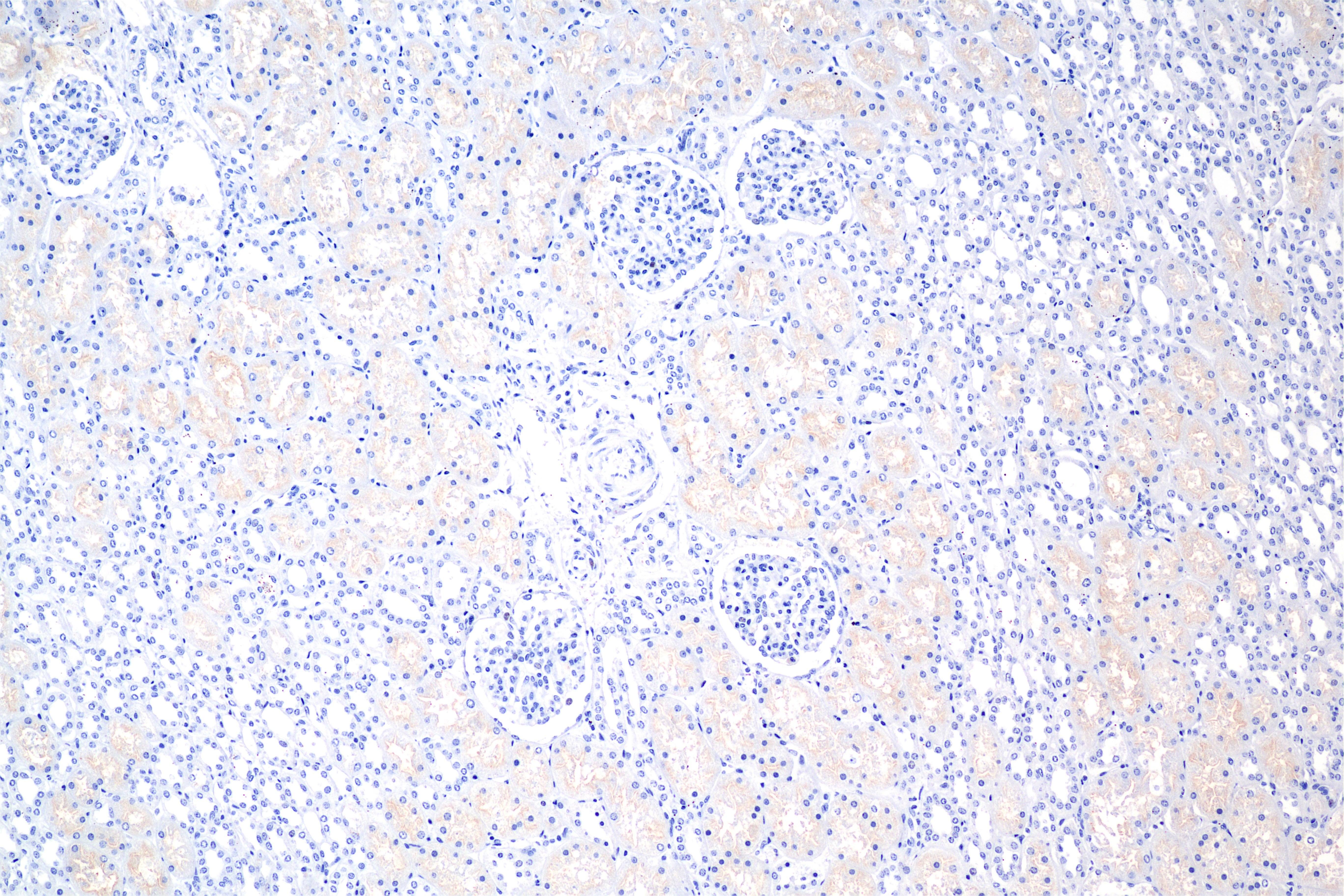 IHC staining of human kidney using 86620-3-RR