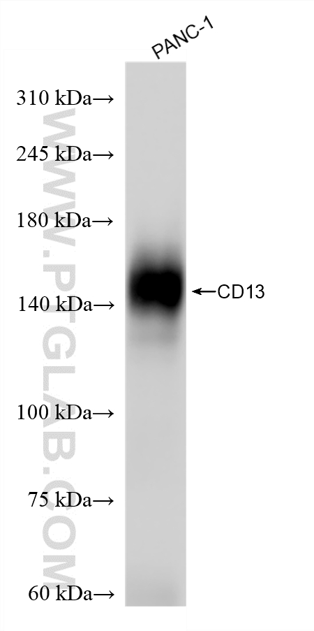 WB analysis of PANC-1 using 86620-3-RR