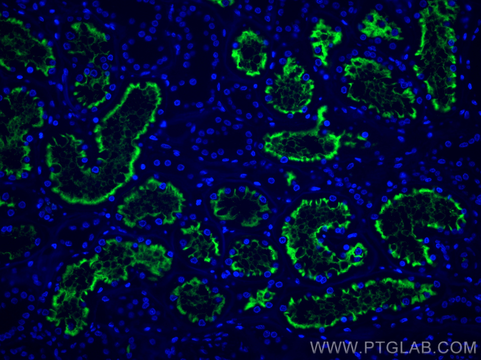 IF Staining of human kidney using CL488-66211