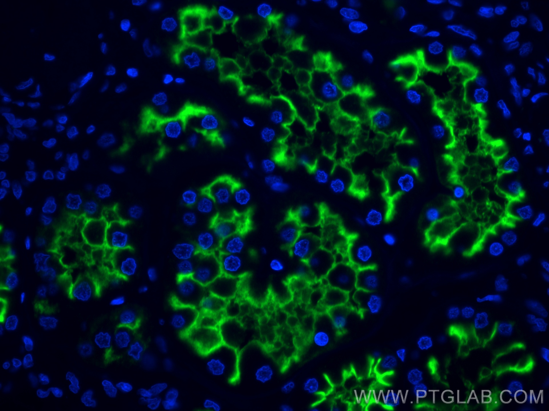 IF Staining of human kidney using CL488-66211