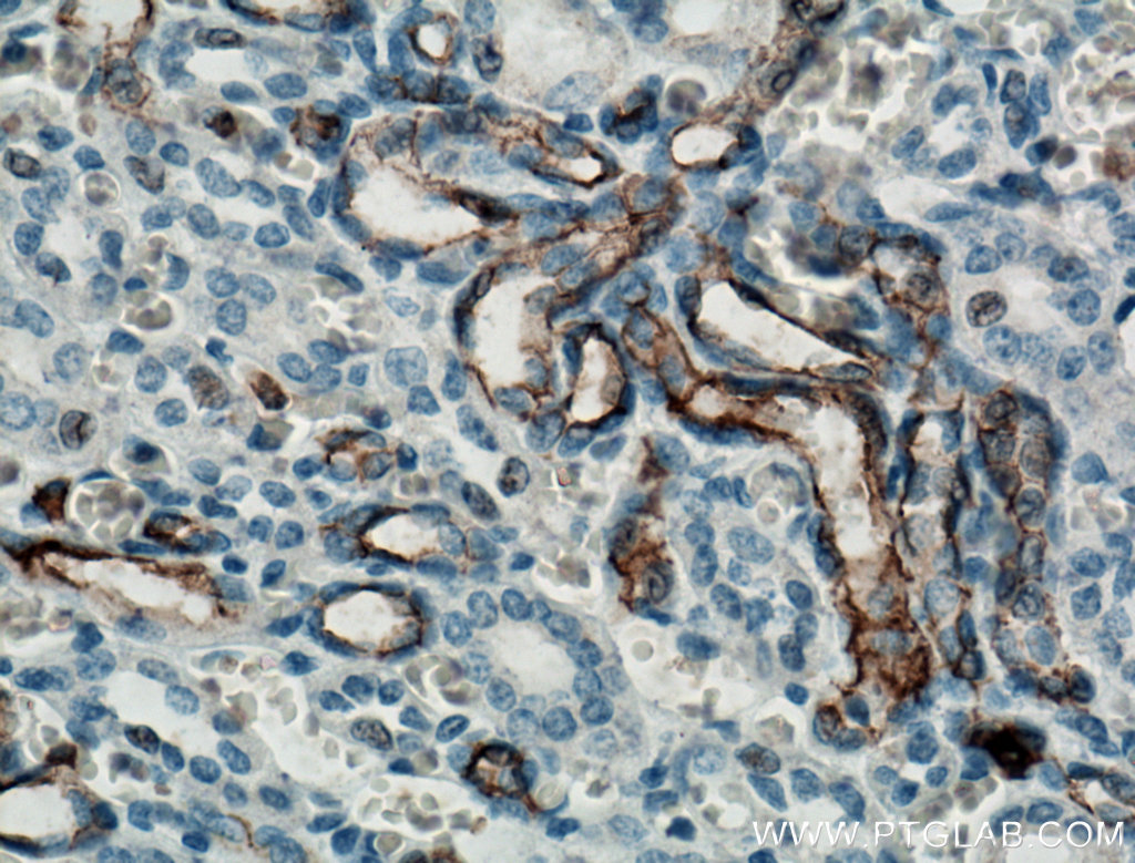 IHC staining of human kidney using 66666-1-Ig (same clone as 66666-1-PBS)