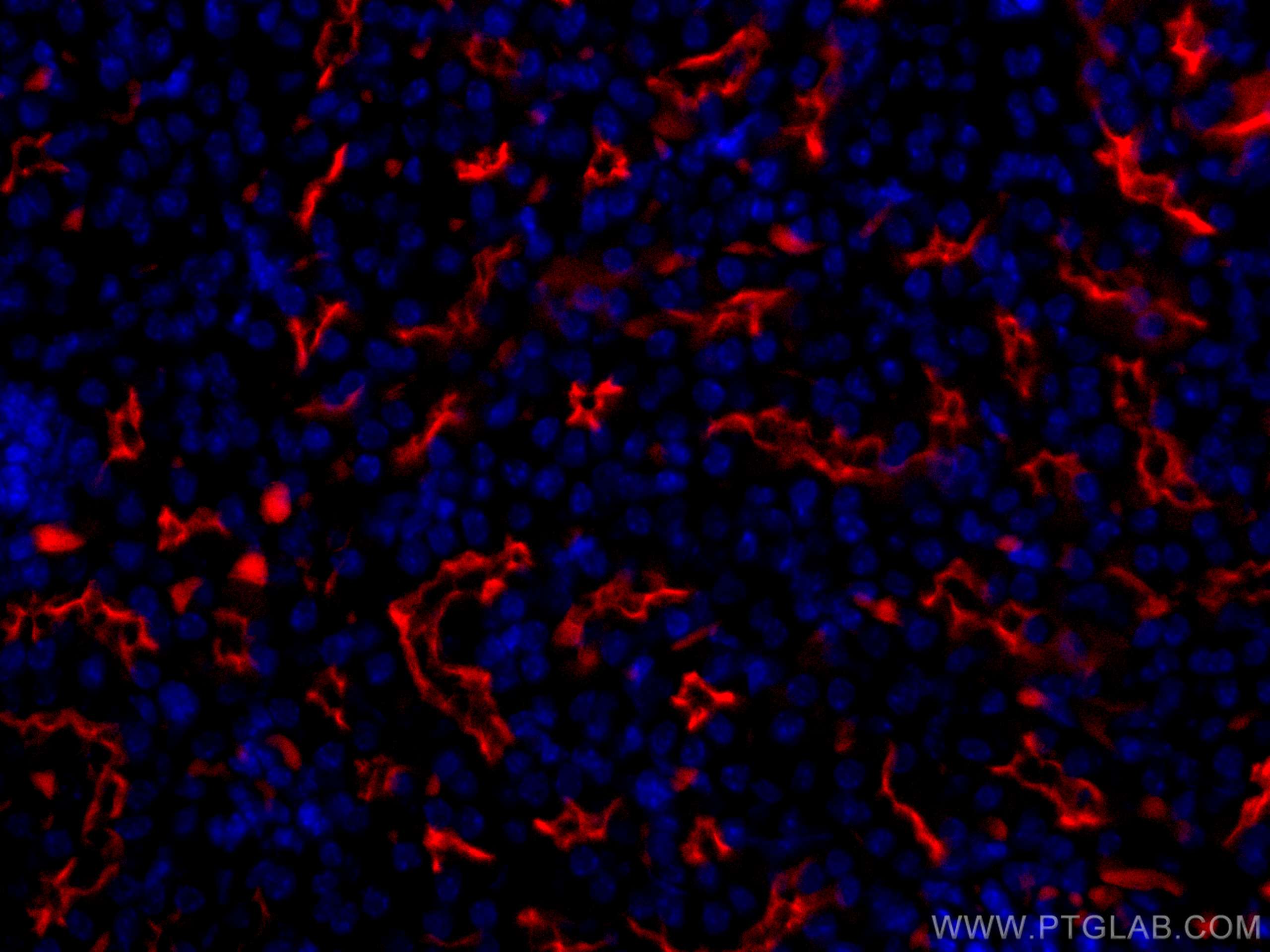 IF Staining of mouse kidney using CL594-18470