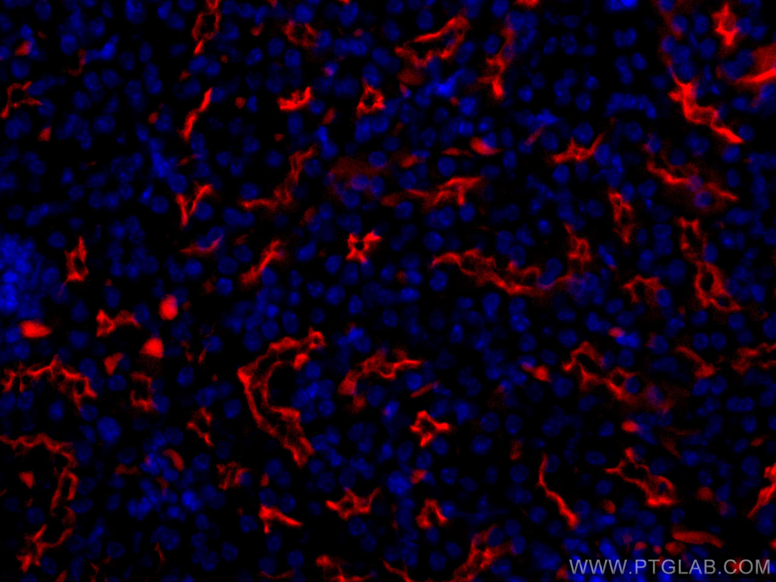 IF Staining of mouse kidney using CL594-18470