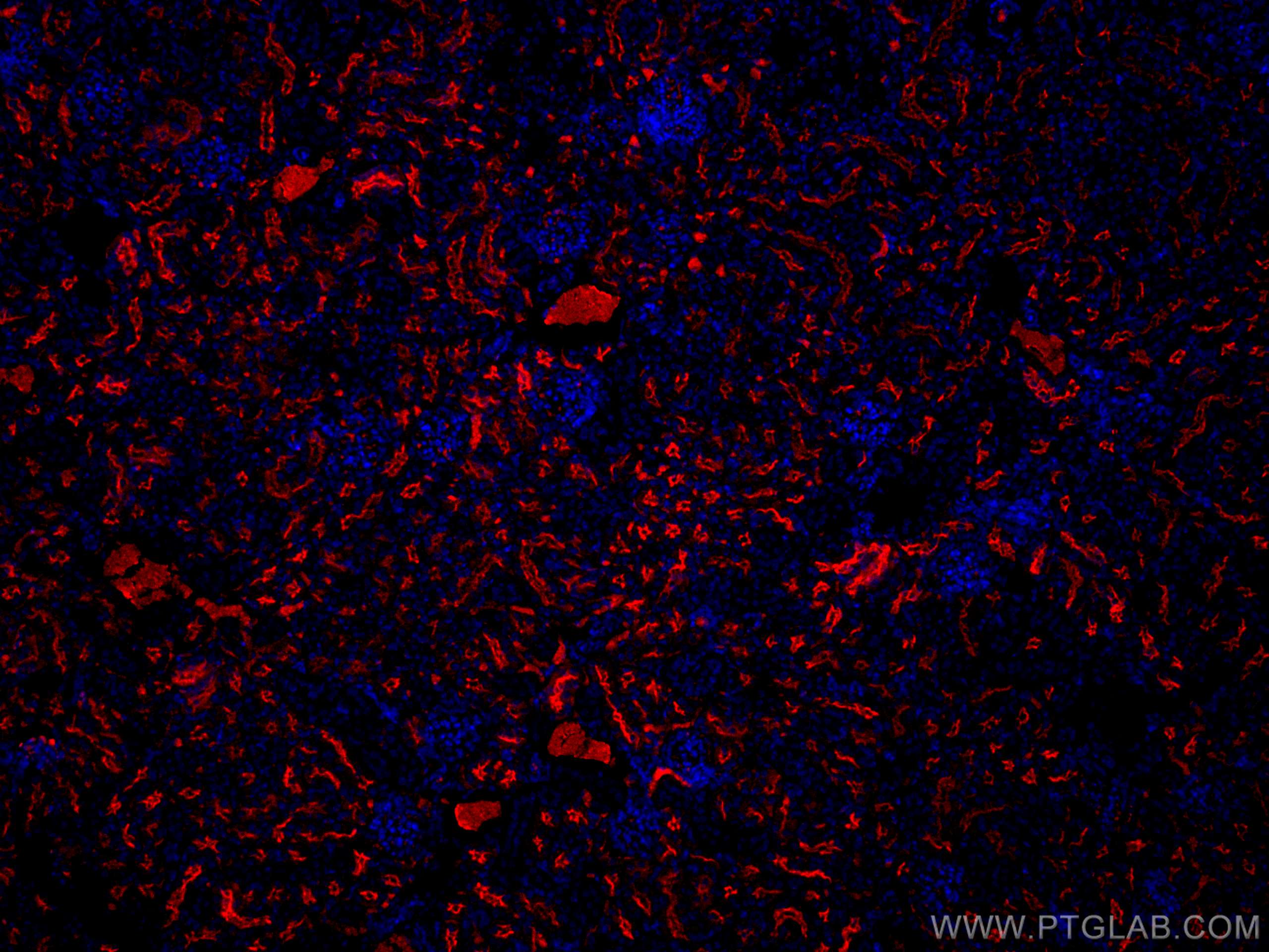 IF Staining of mouse kidney using CL594-18470
