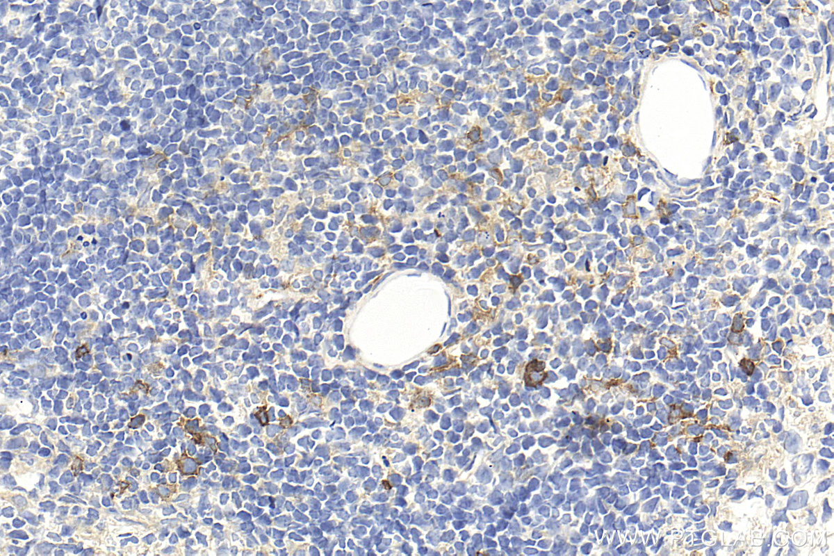 IHC staining of mouse spleen using 32621-1-AP