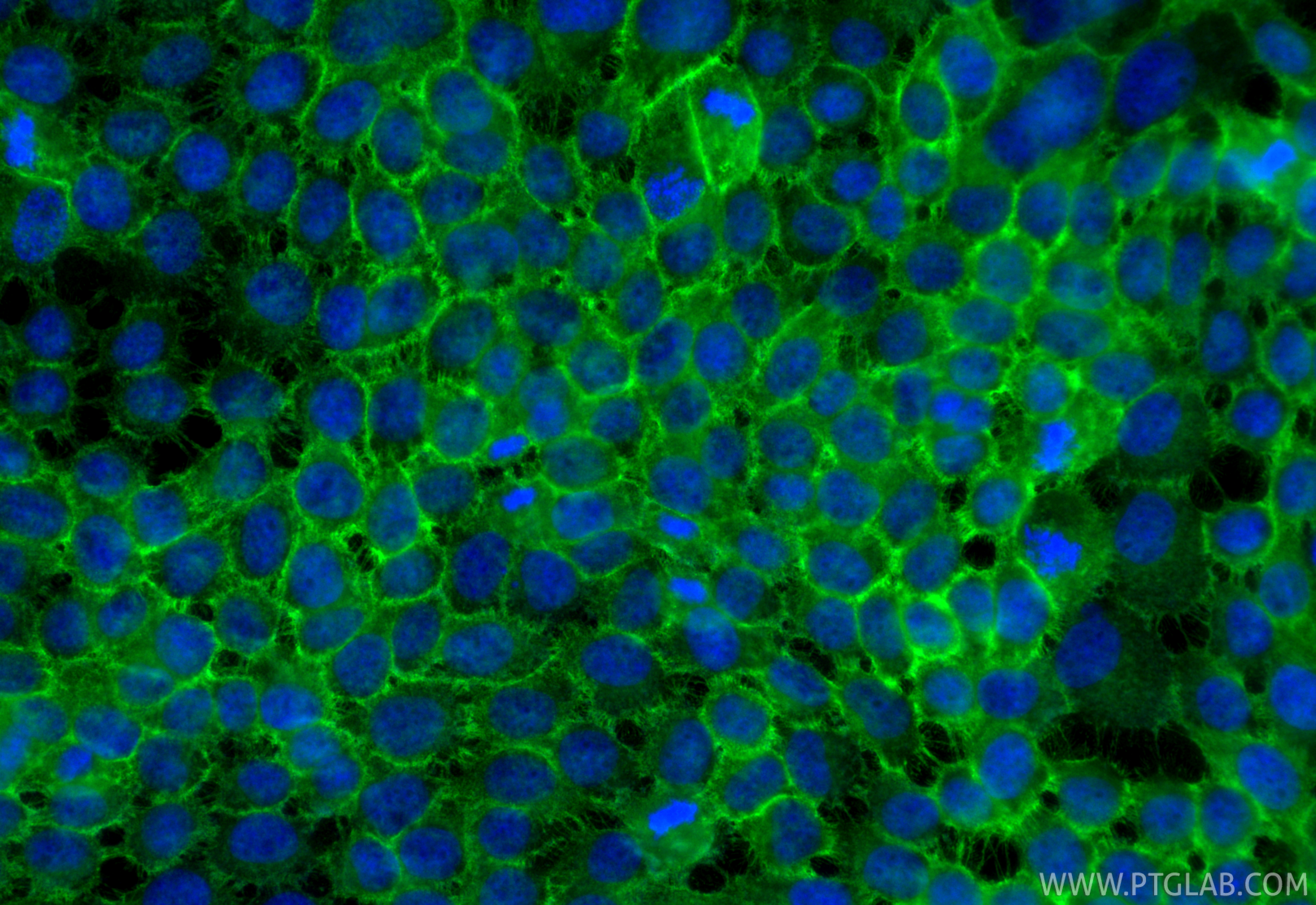 IF Staining of A431 using 31341-1-AP IF Staining of A431 using 31341-1-AP