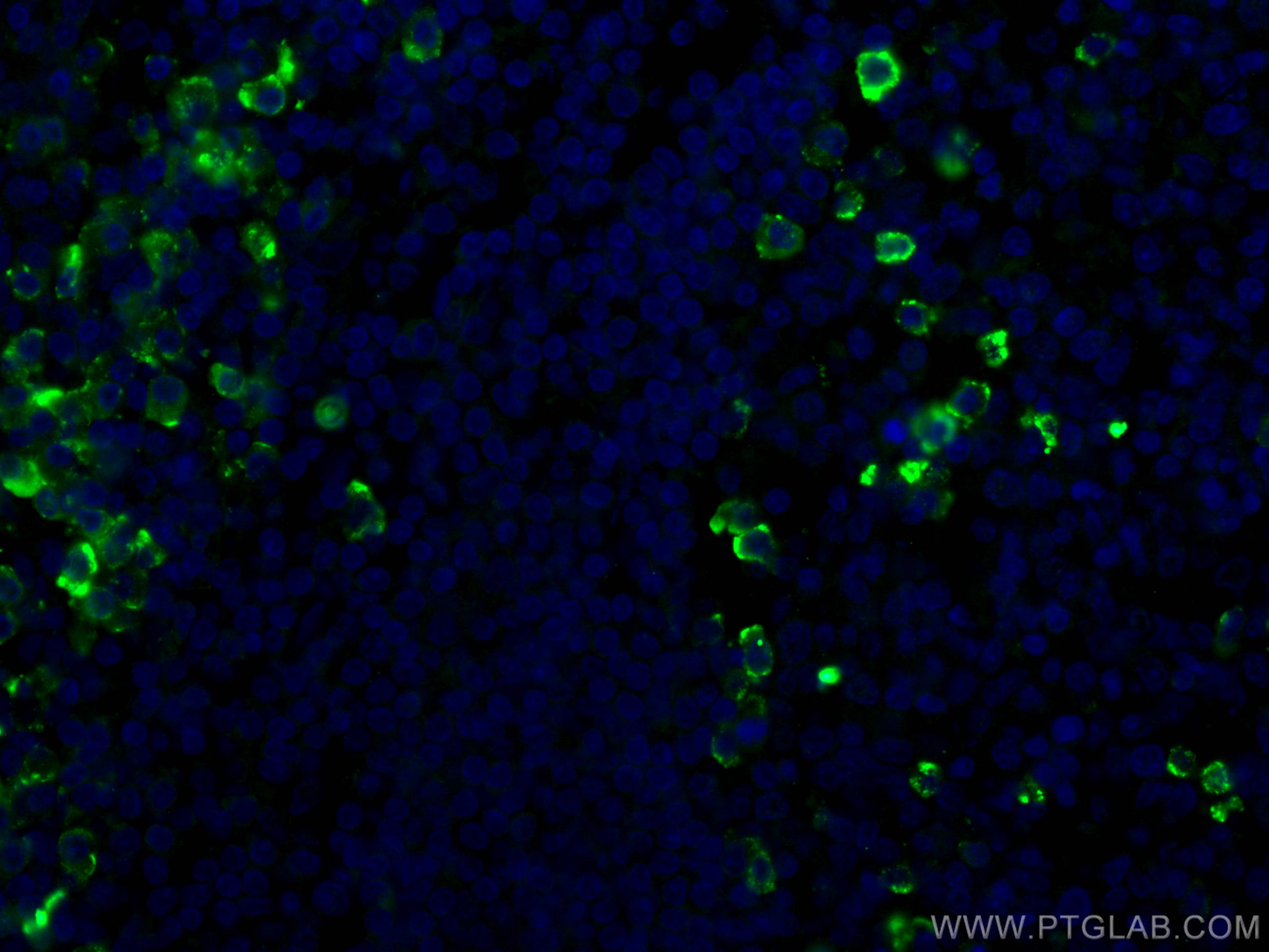 IF Staining of human tonsillitis using 67155-1-Ig (same clone as 67155-1-PBS)