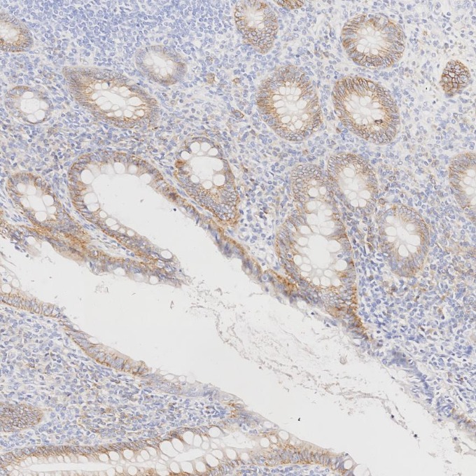 IHC staining of human appendicitis using 67155-1-Ig