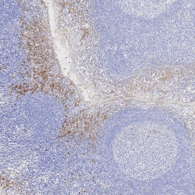 IHC staining of human tonsillitis using 67155-1-Ig