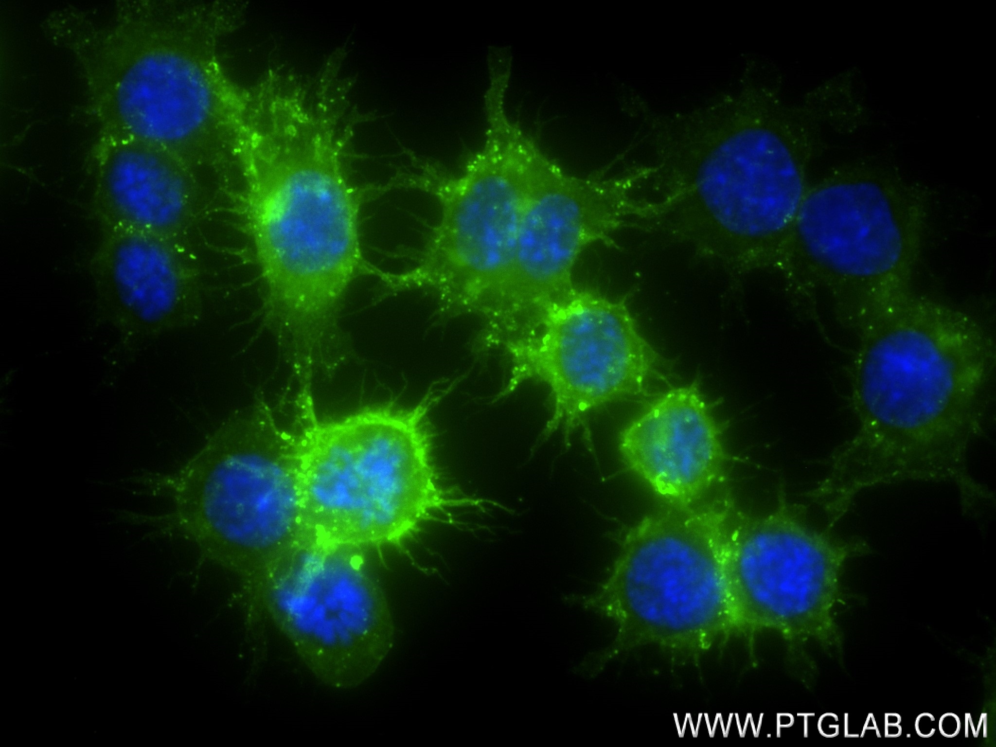 IF Staining of RAW 264.7 using 83297-5-RR (same clone as 83297-5-PBS)