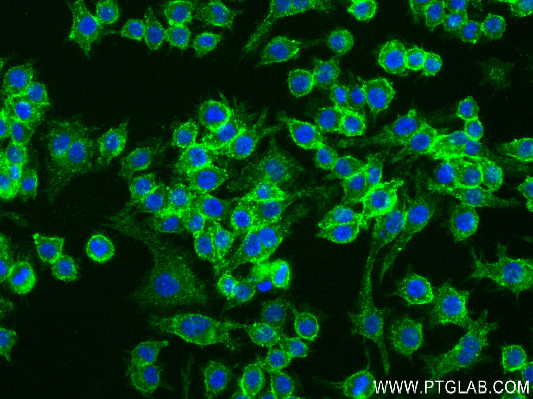 IF Staining of RAW 264.7 using 83297-7-RR